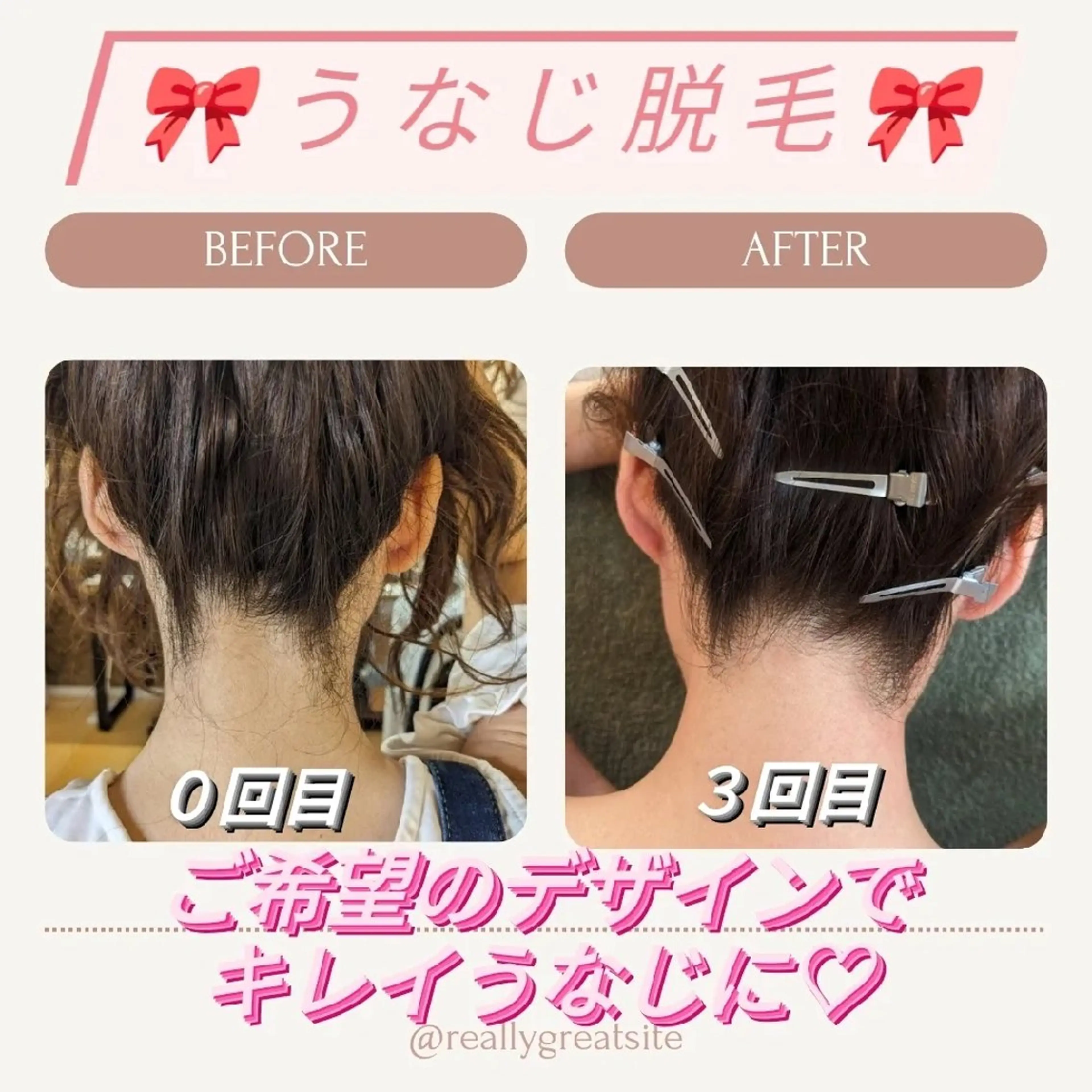 プライベートサロン宿り木所属・江坂@宿り木　脱毛＆ 耳ツボジュエリーのその他イメージ