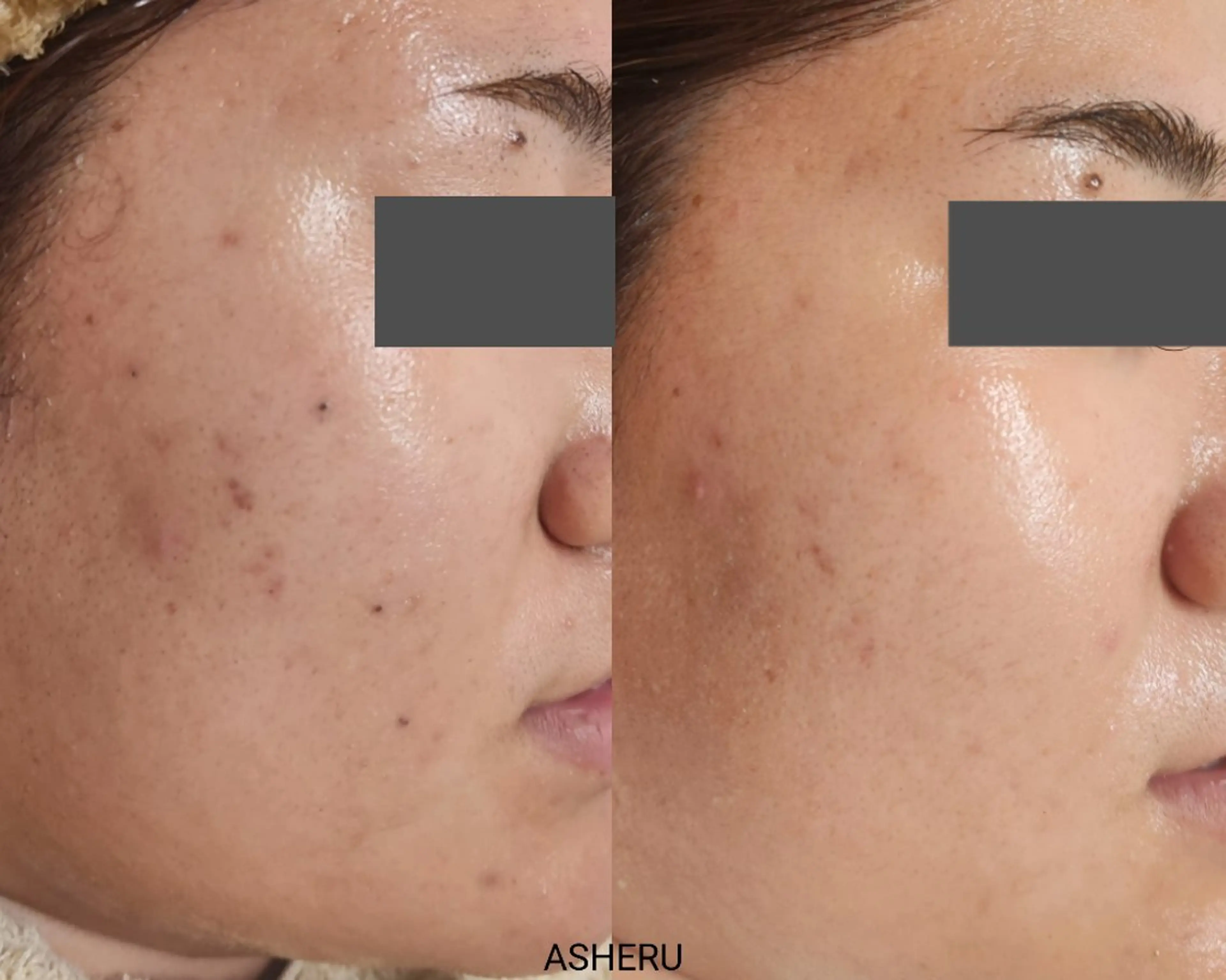 エステ ASHERU* Yuiのエステ・リラクイメージ