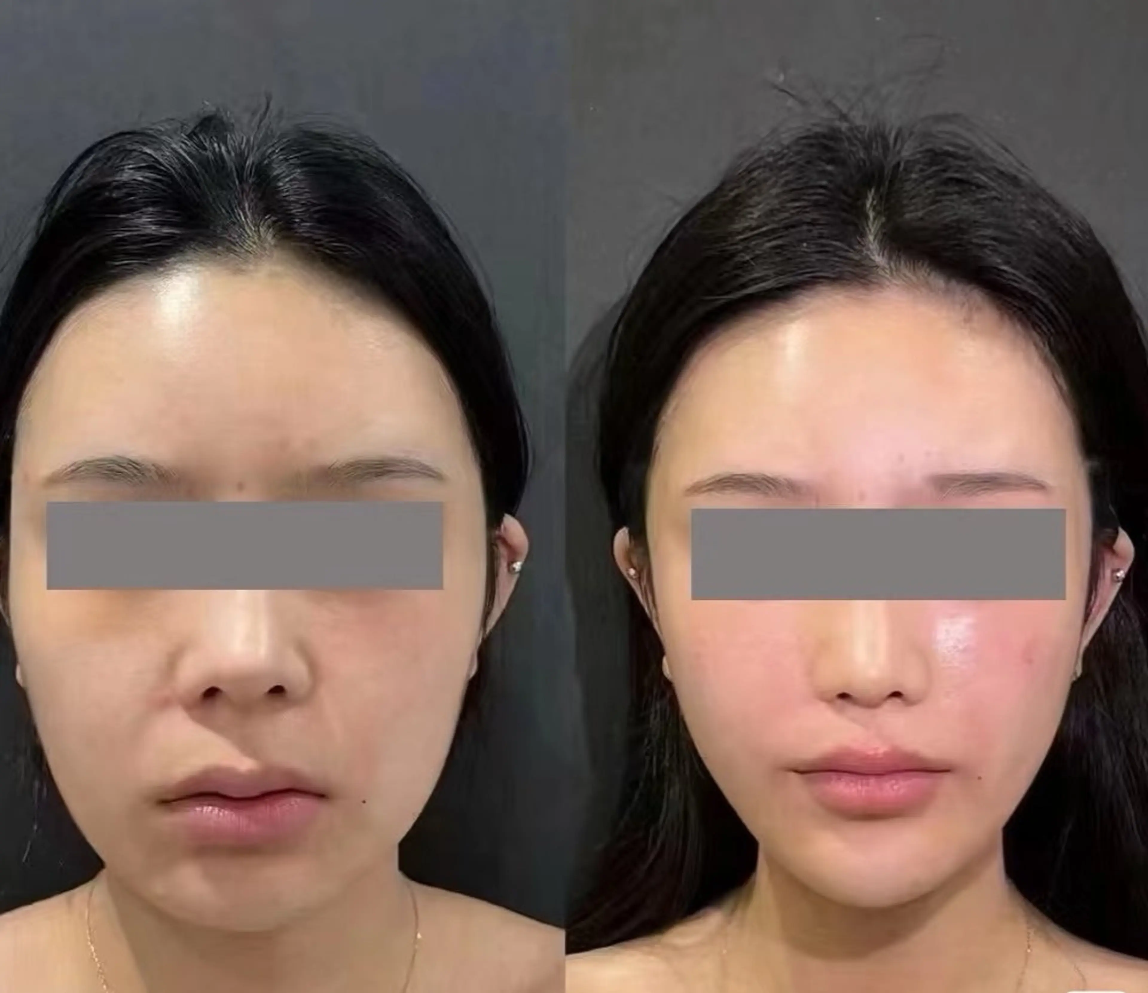 エステ aliaハイフ&水光ジェットサロン所属・aliaハーブ水光店 エステティシャン募集のエステ・リラクイメージ