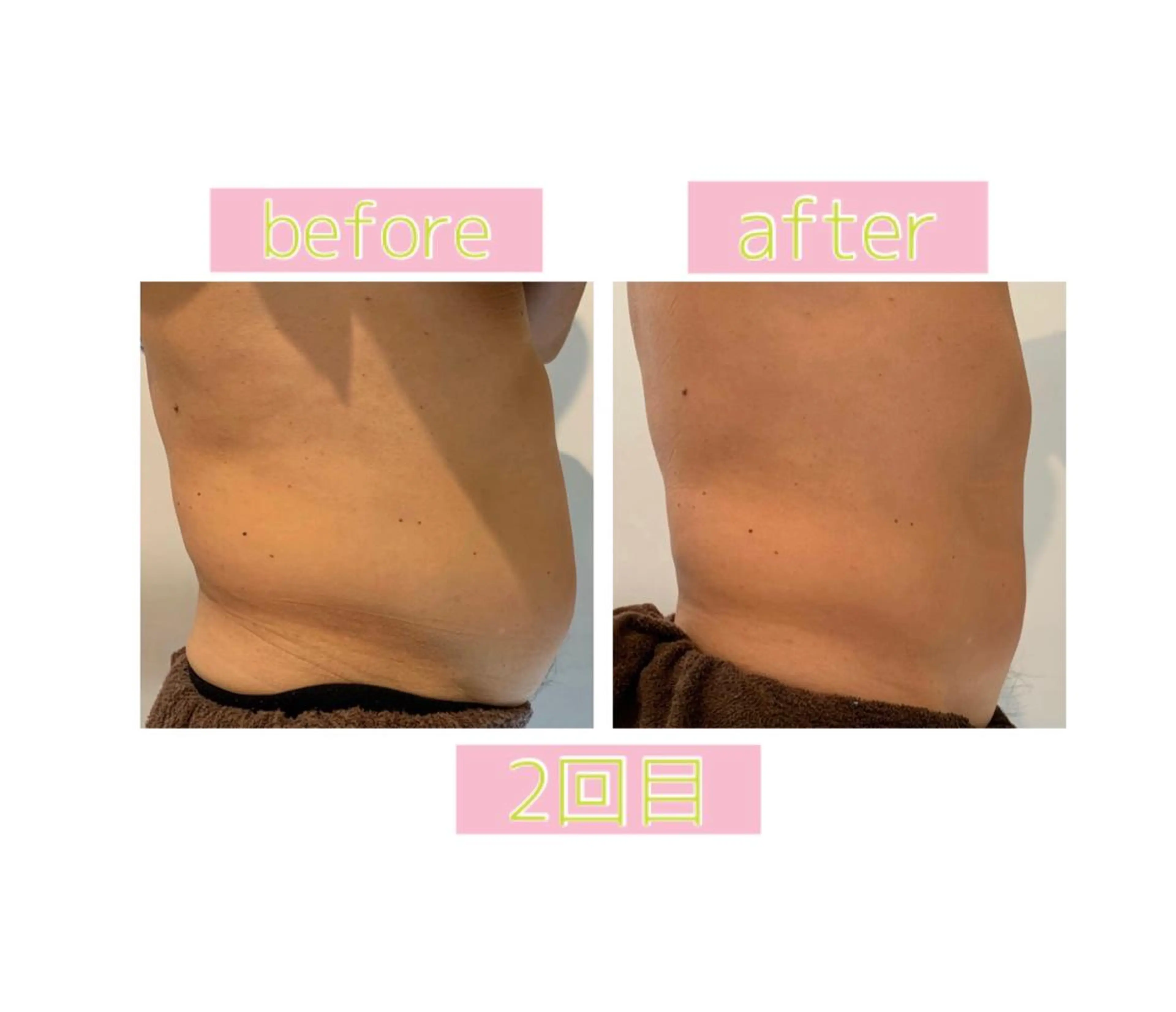 メンズ エステ 癒し腸もみサロン シャユーム　ゆきなのエステ・リラクイメージ