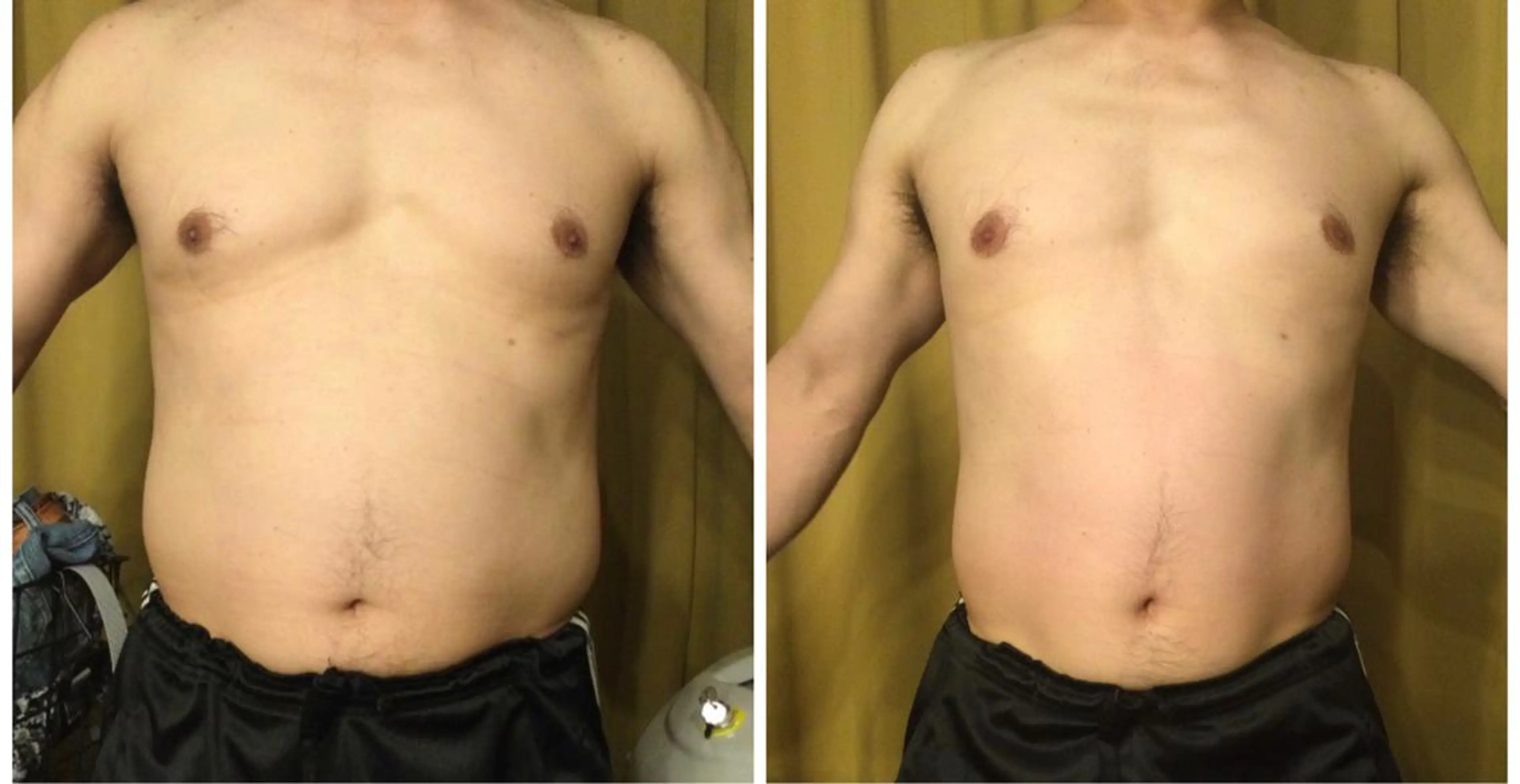 エステ 小顔やたるみに特化 💚野瀬可蓮のその他イメージ