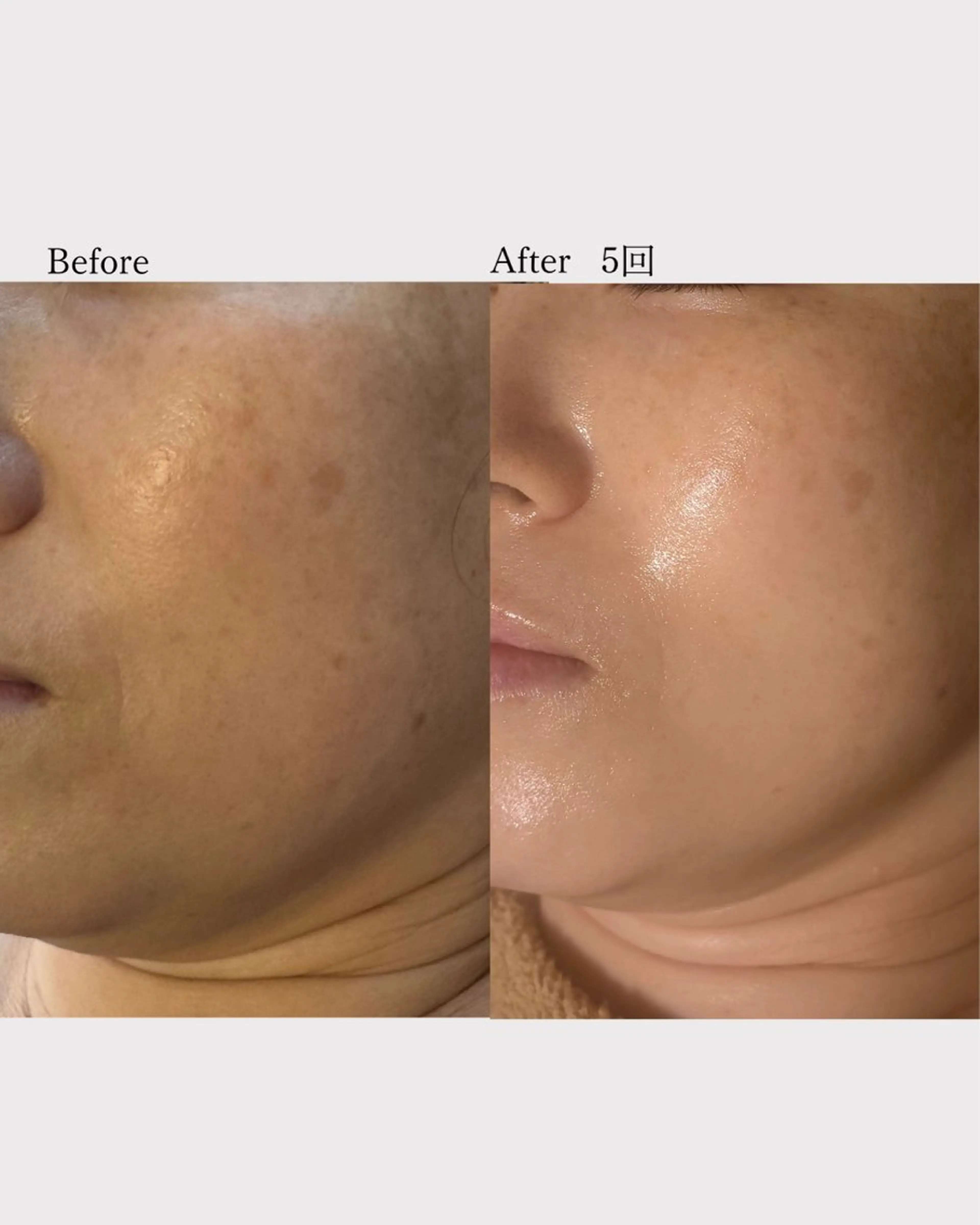 肌管理フェイシャル|Utouto所属・肌管理フェイシャル Utoutoのエステ・リラクイメージ