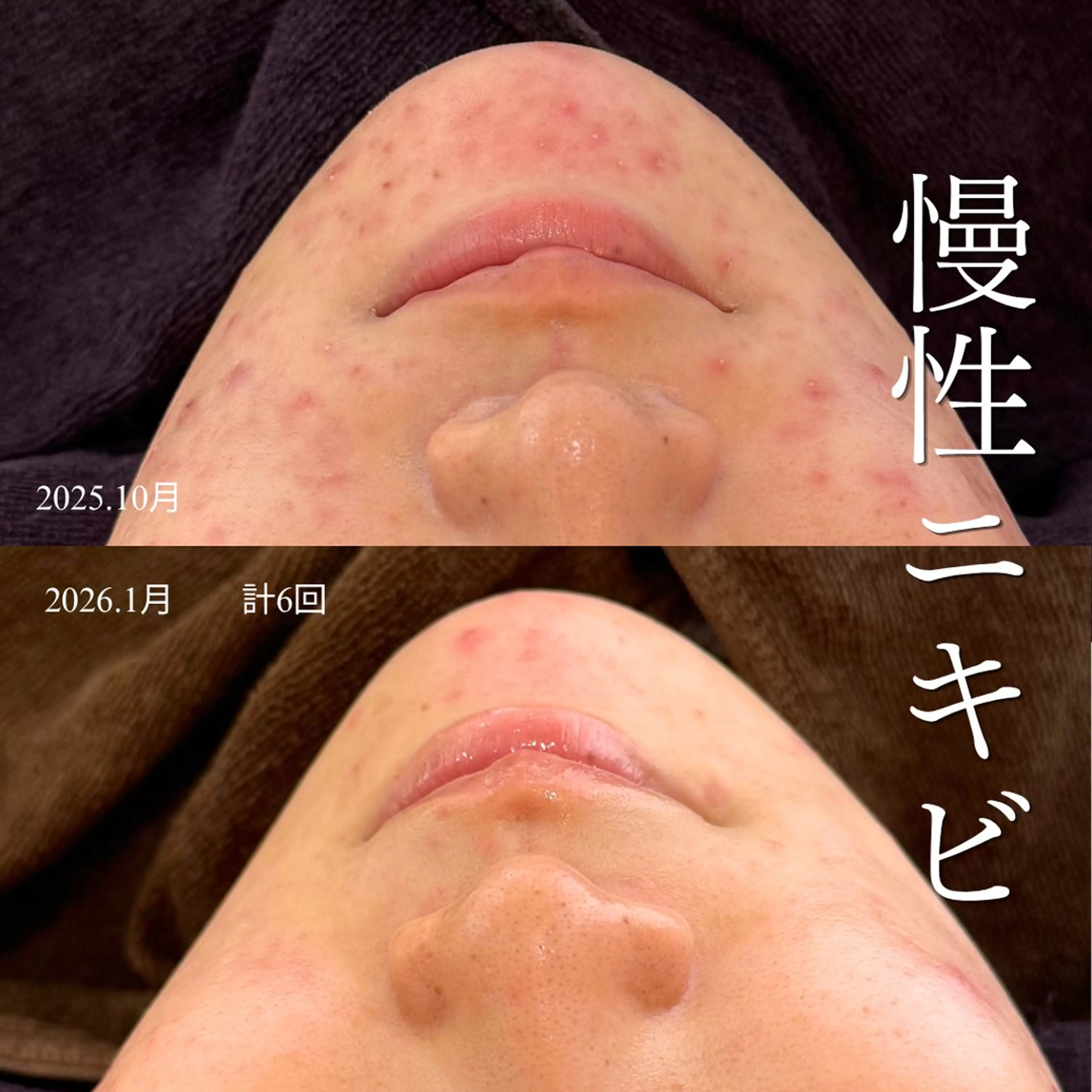 エステ yukiko/中崎町 肌質改善/ハーブ🌿のエステ・リラクイメージ