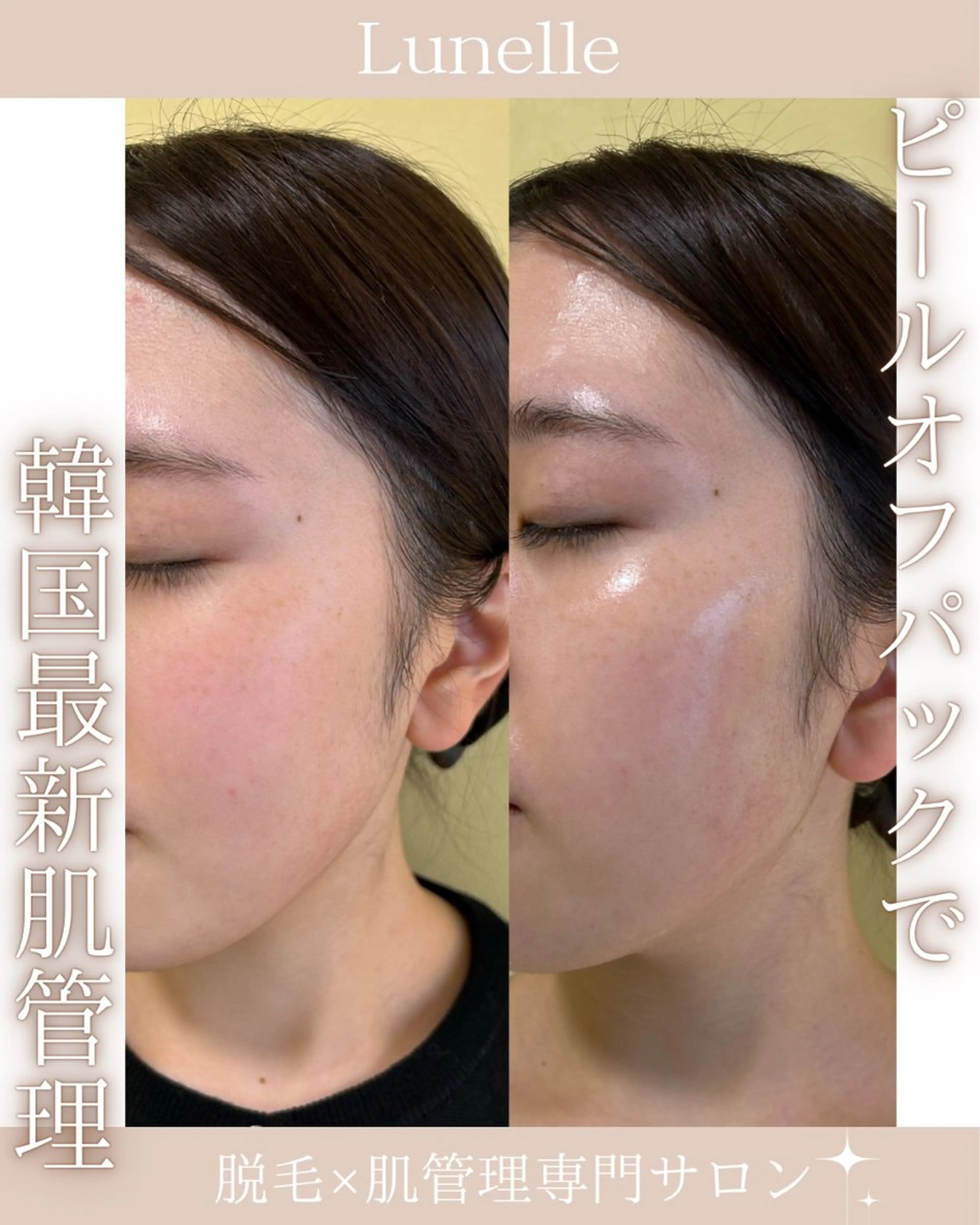 その他 脱毛×肌管理サロン ルネルのエステ・リラクイメージ