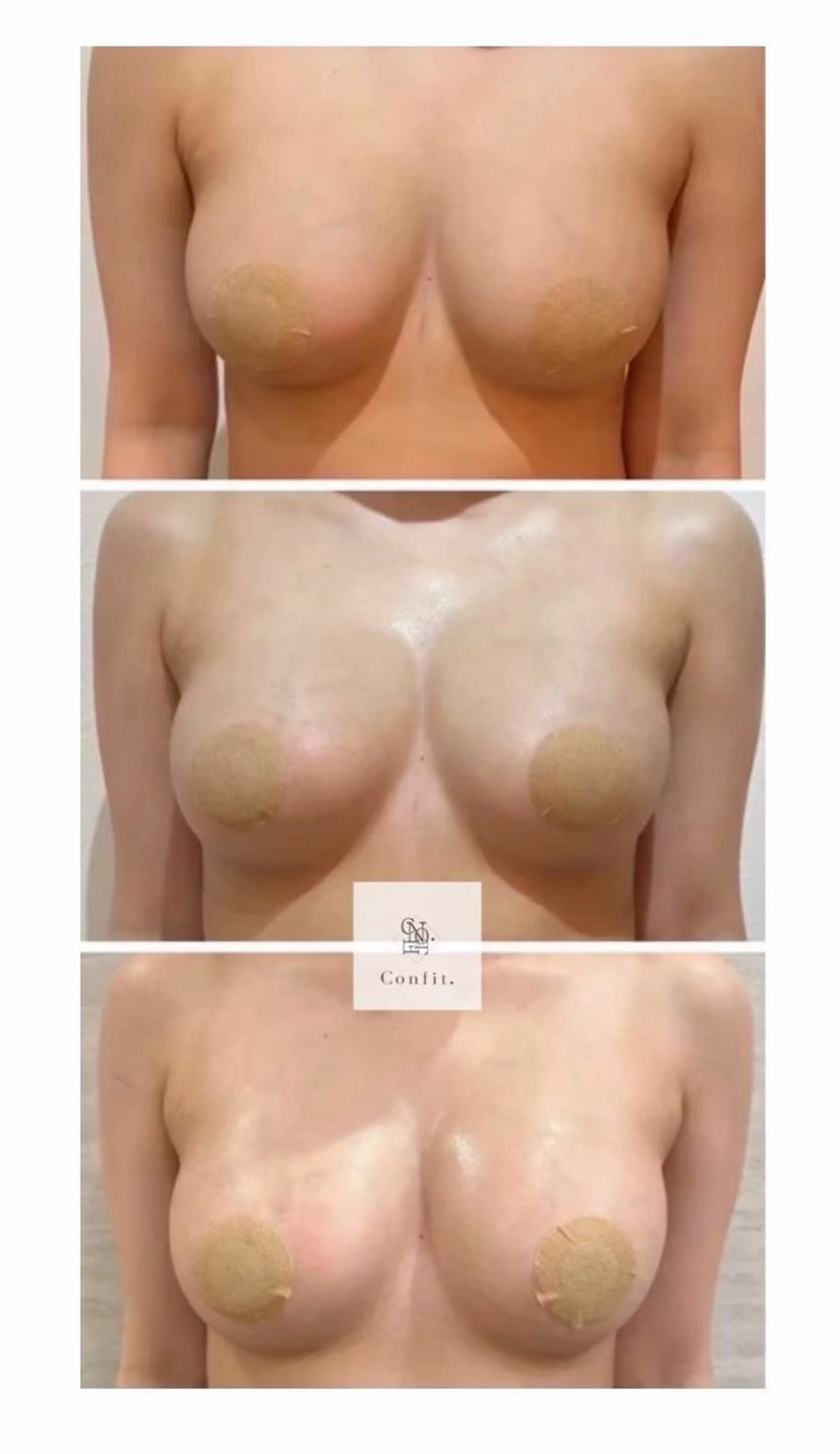 エステ 小顔/たるみ/黒ずみ除去専門サロン/SONA 大和西大寺店所属・【小顔痩身専門看護師 サロンSONA】のエステ・リラクイメージ