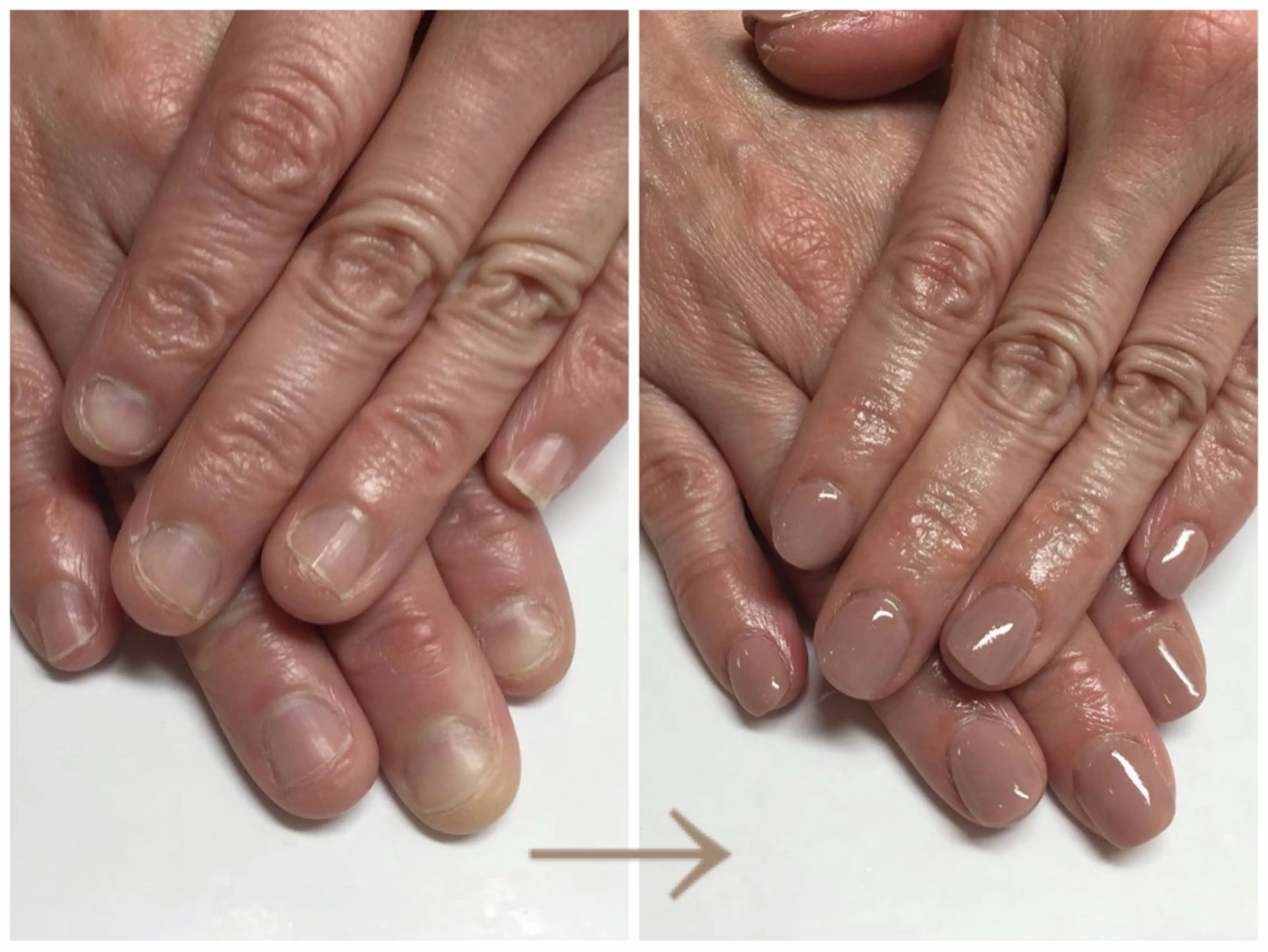 ネイル ワンカラーネイル 深爪矯正・自爪育成 ヴェールリムのネイルデザイン