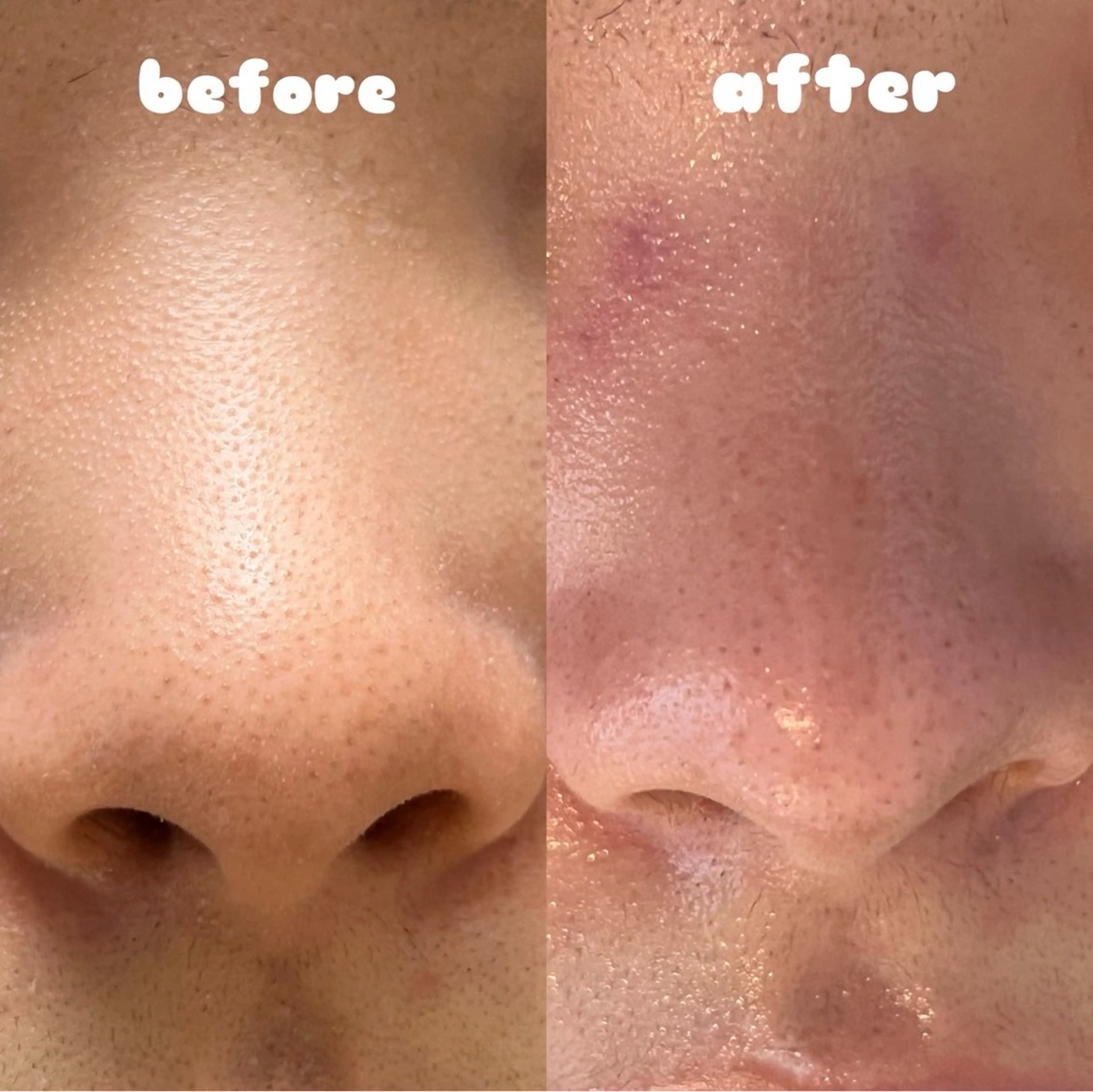 エステ リンパ×ハーブ蒸し TIARA.烏丸三条のエステ・リラクイメージ