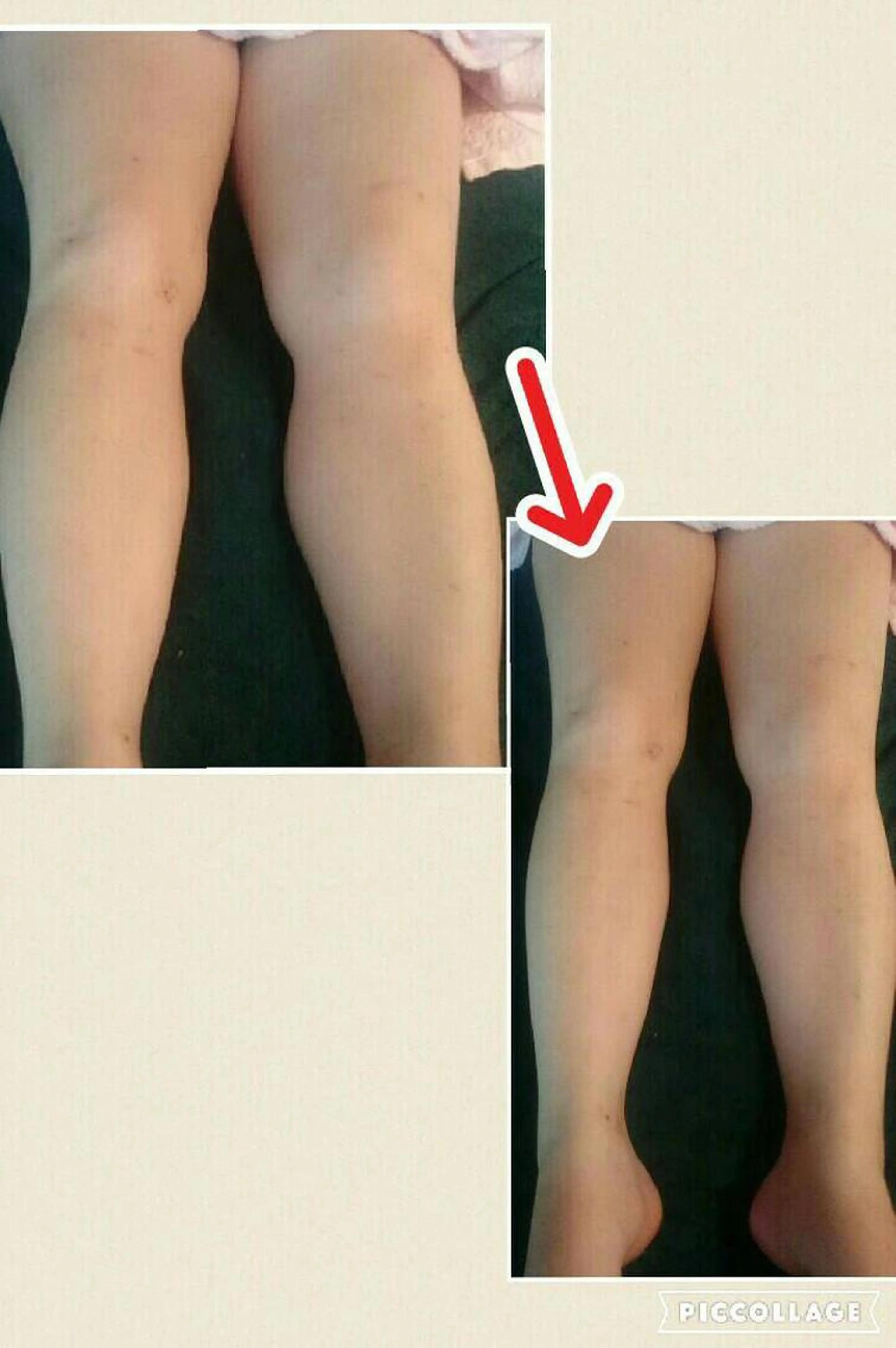 テラピーの写真