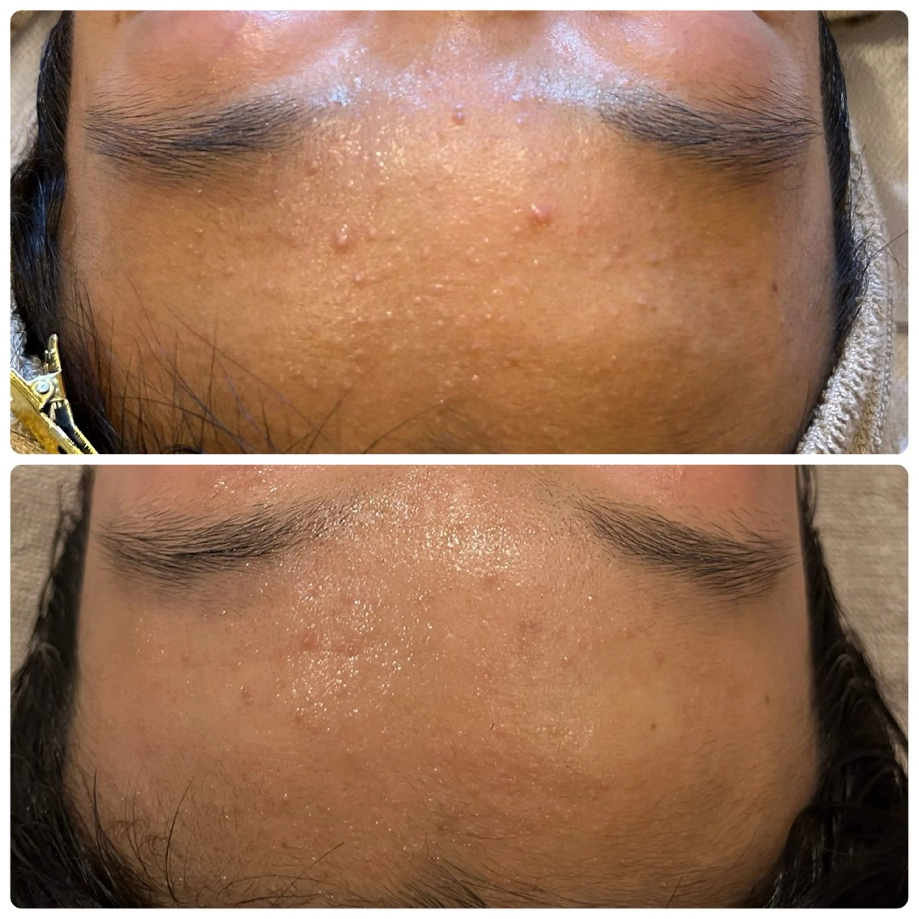 エステ yellow.所属・yellow💛【 脱毛&フェイシャル】のエステ・リラクイメージ