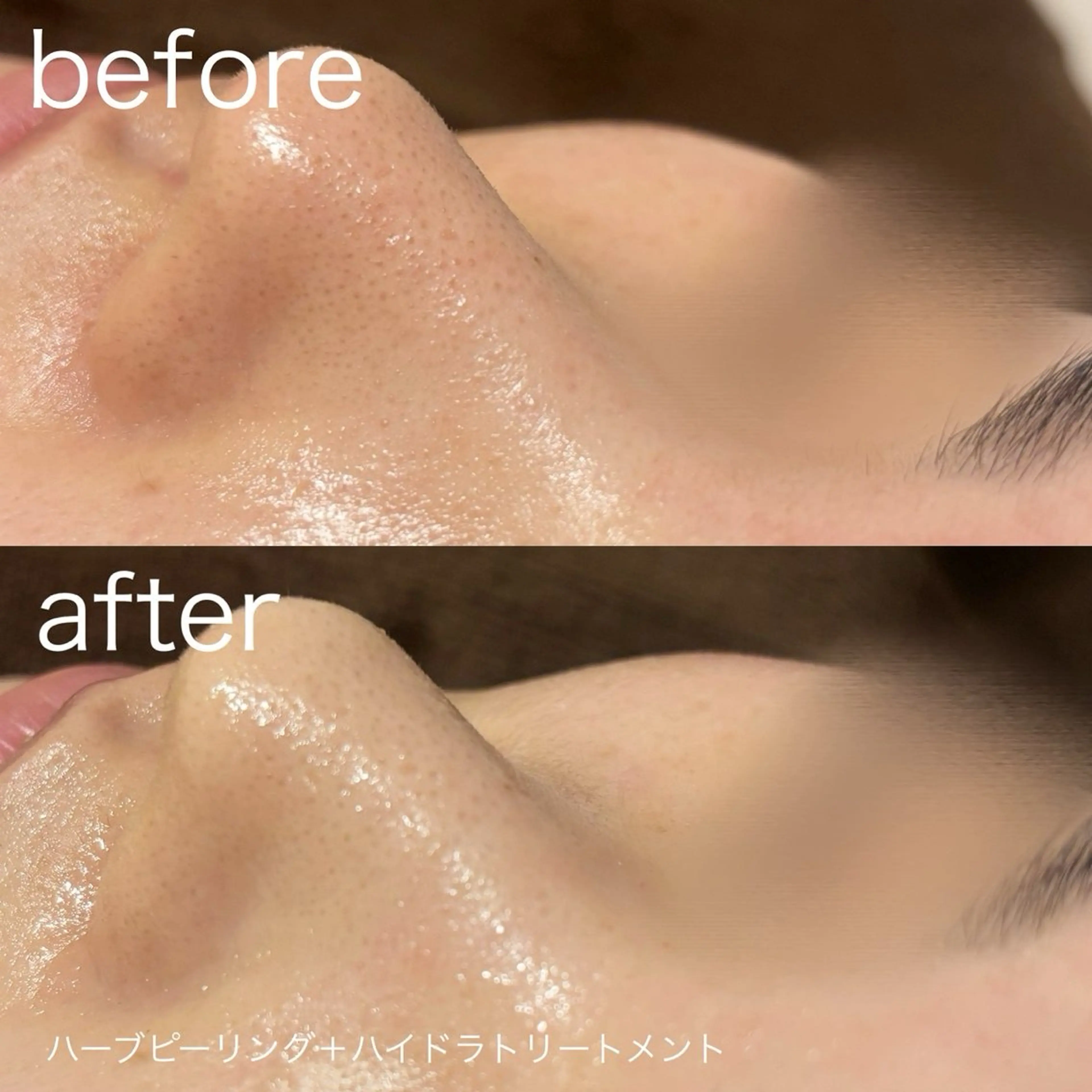 脱毛 lulularico Yuのエステ・リラクイメージ