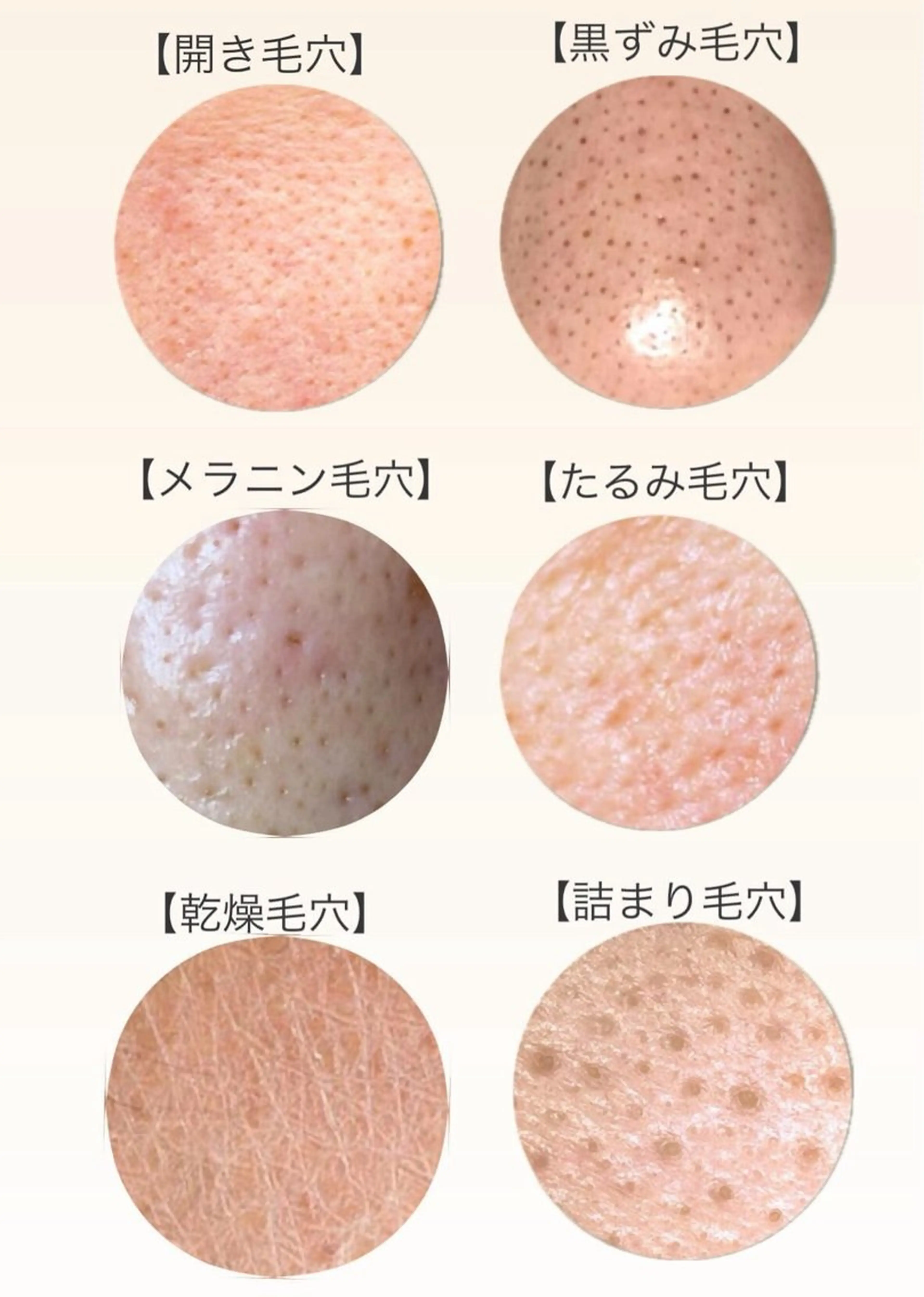 エステ リラク 【vidyto】ヴィディトゥ所属・肌管理サロン vidyto　MOEのその他イメージ