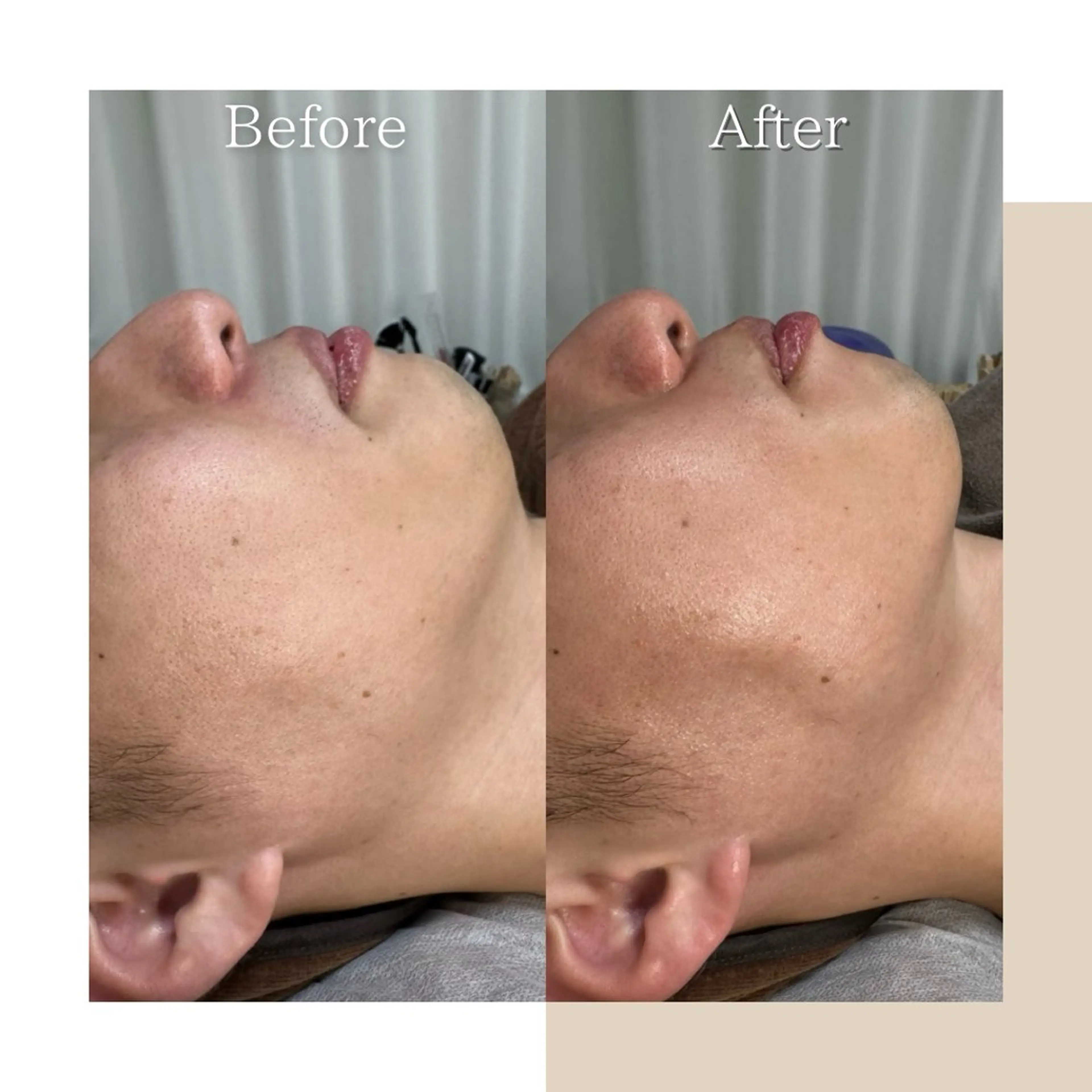 エステ LULA大宮店 YOSHIWARAの眉毛・アイブロウイメージ