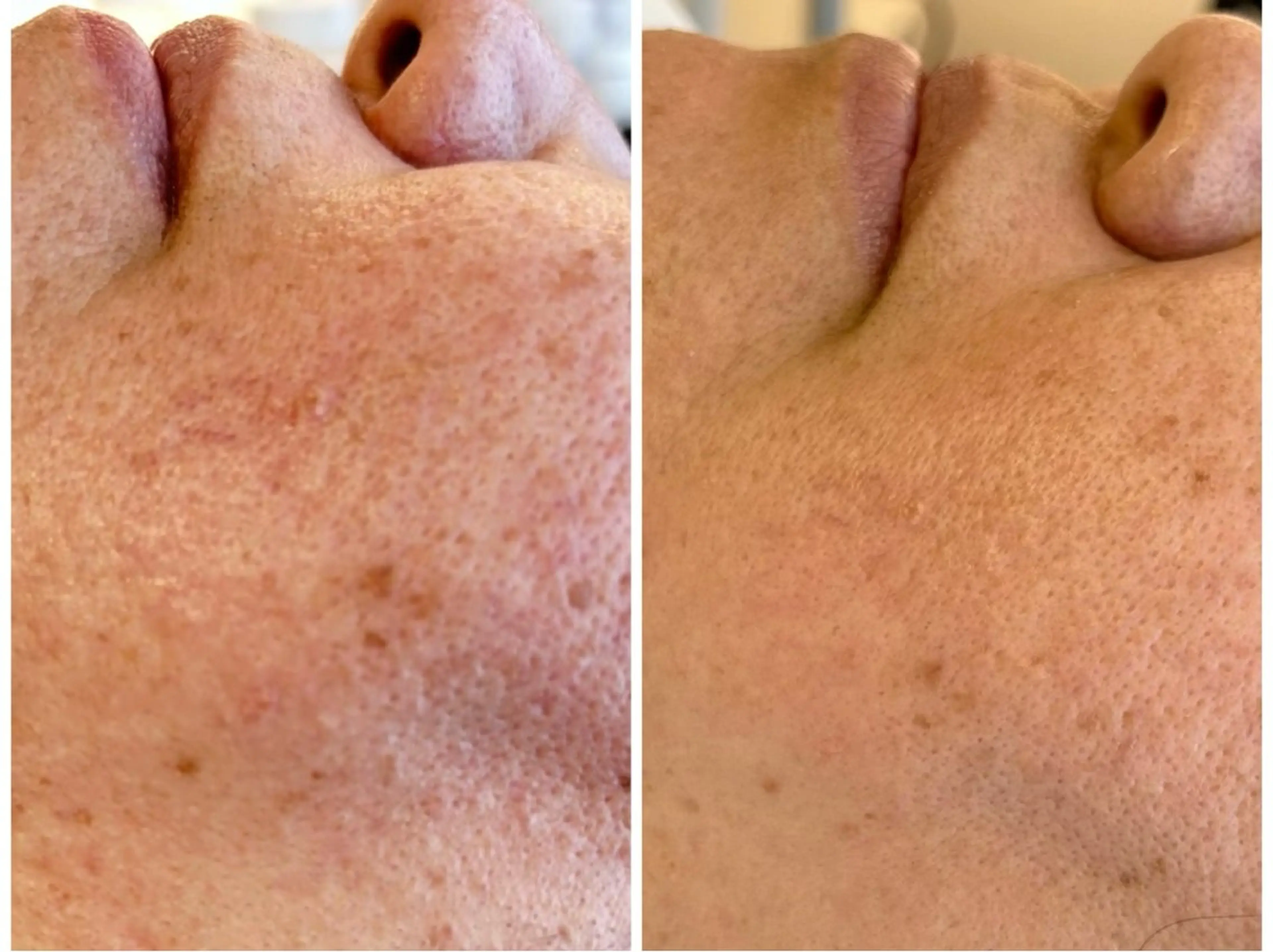 エステサロンMee. 大畑のエステ・リラクイメージ