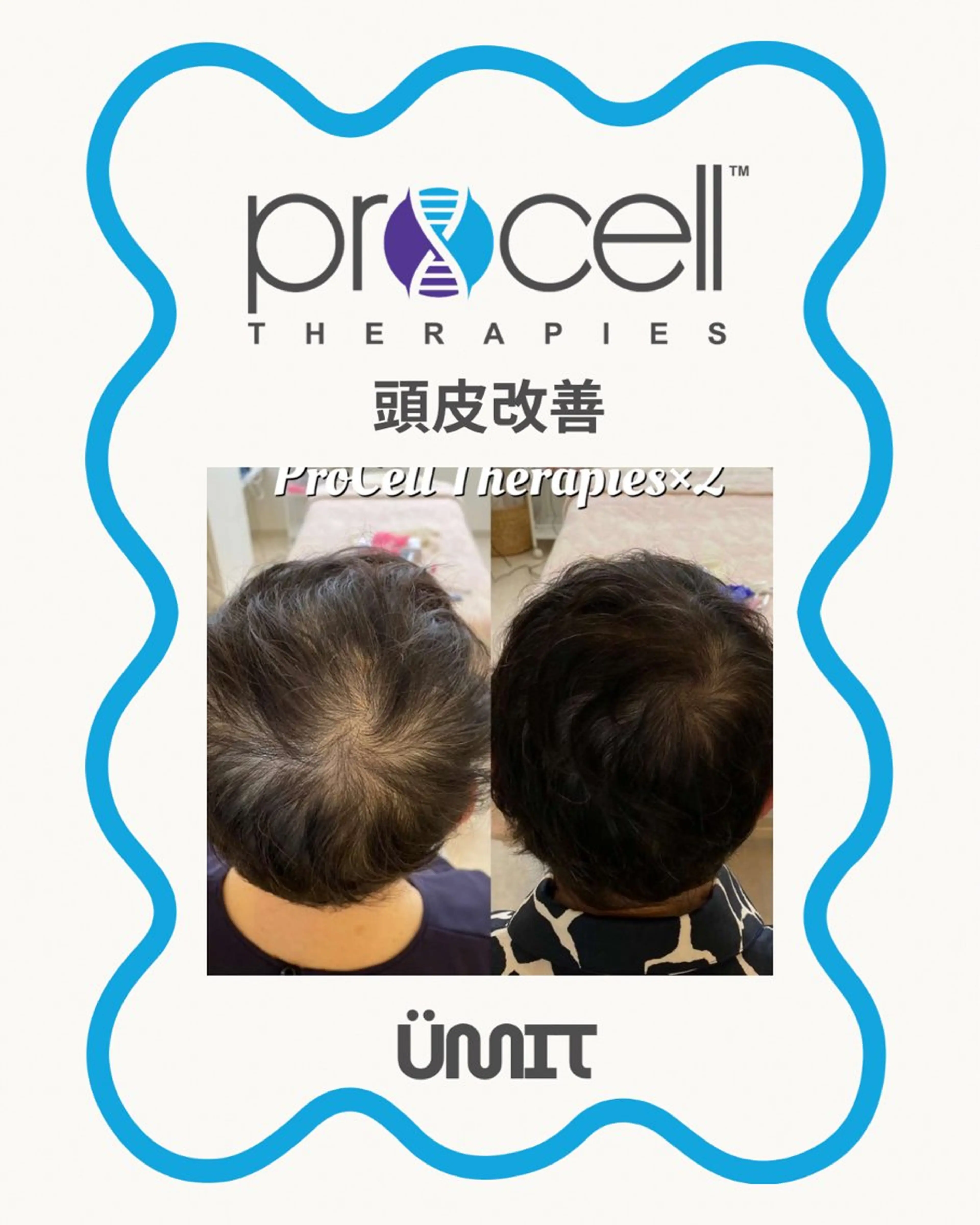 メンズ ヘッドスパ Ümit（ユミト） プロセルセラピーズのヘアスタイル