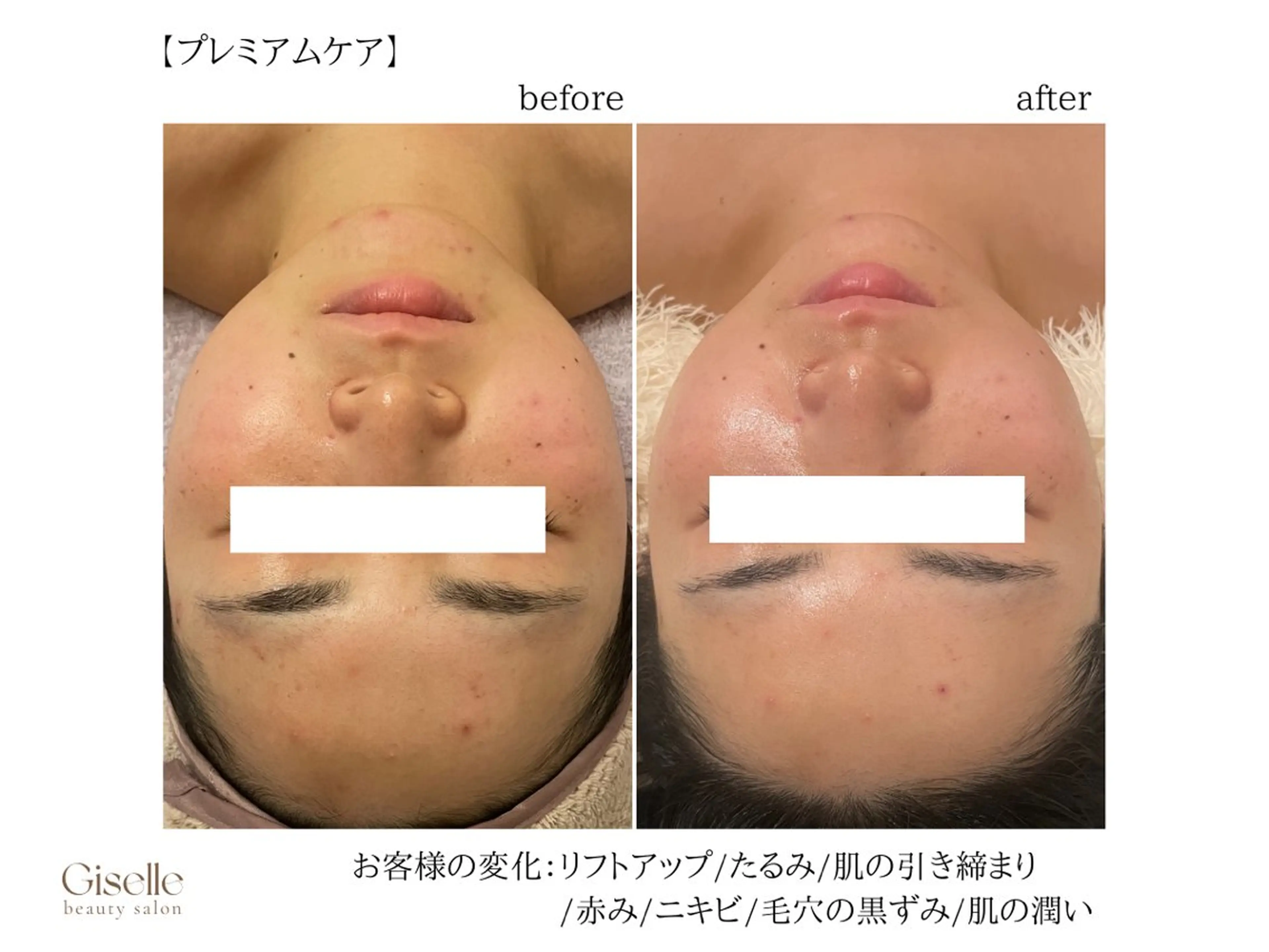 エステ 渡邉 由佳のエステ・リラクイメージ