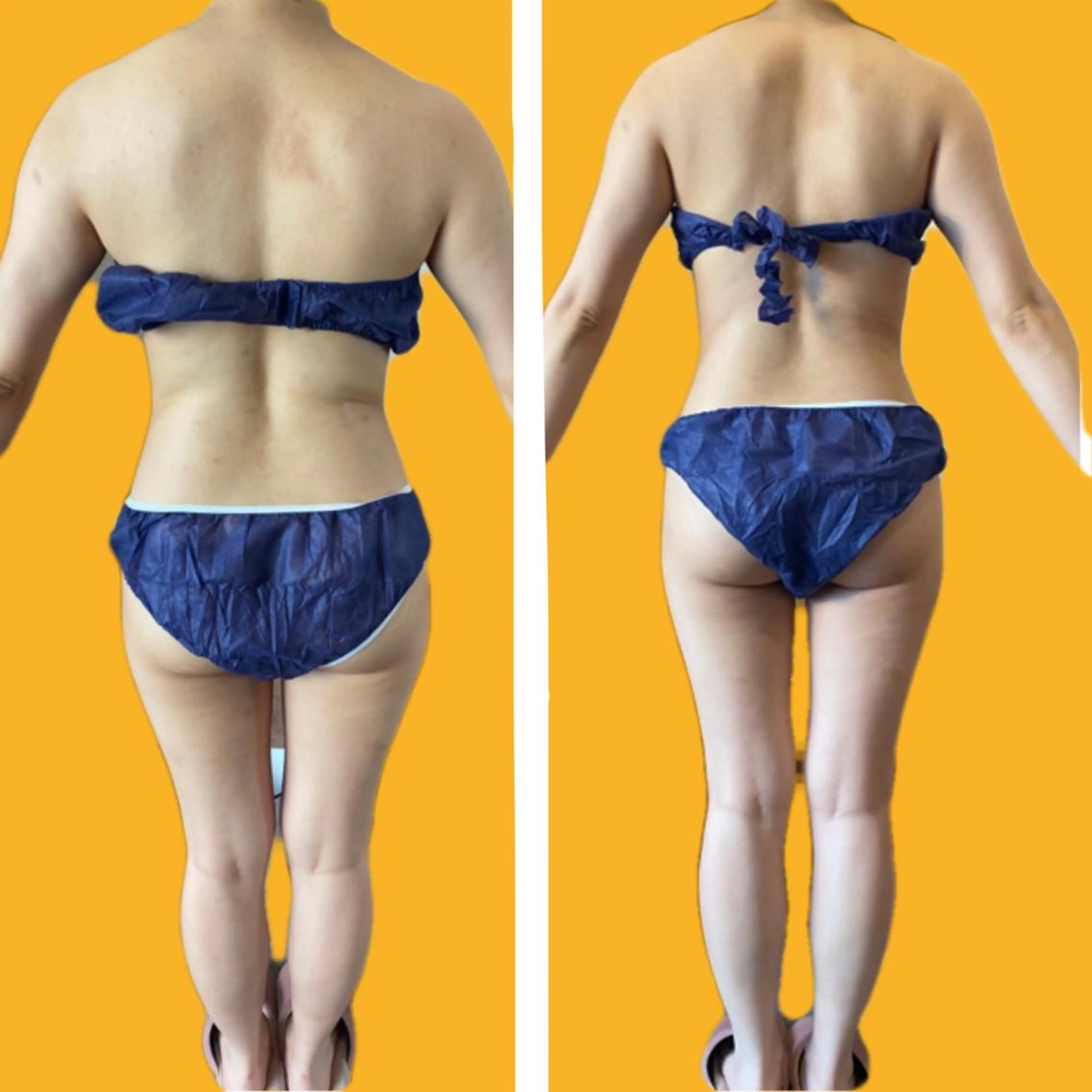 バストケア RAYVIS梅田店Nのエステ・リラクイメージ