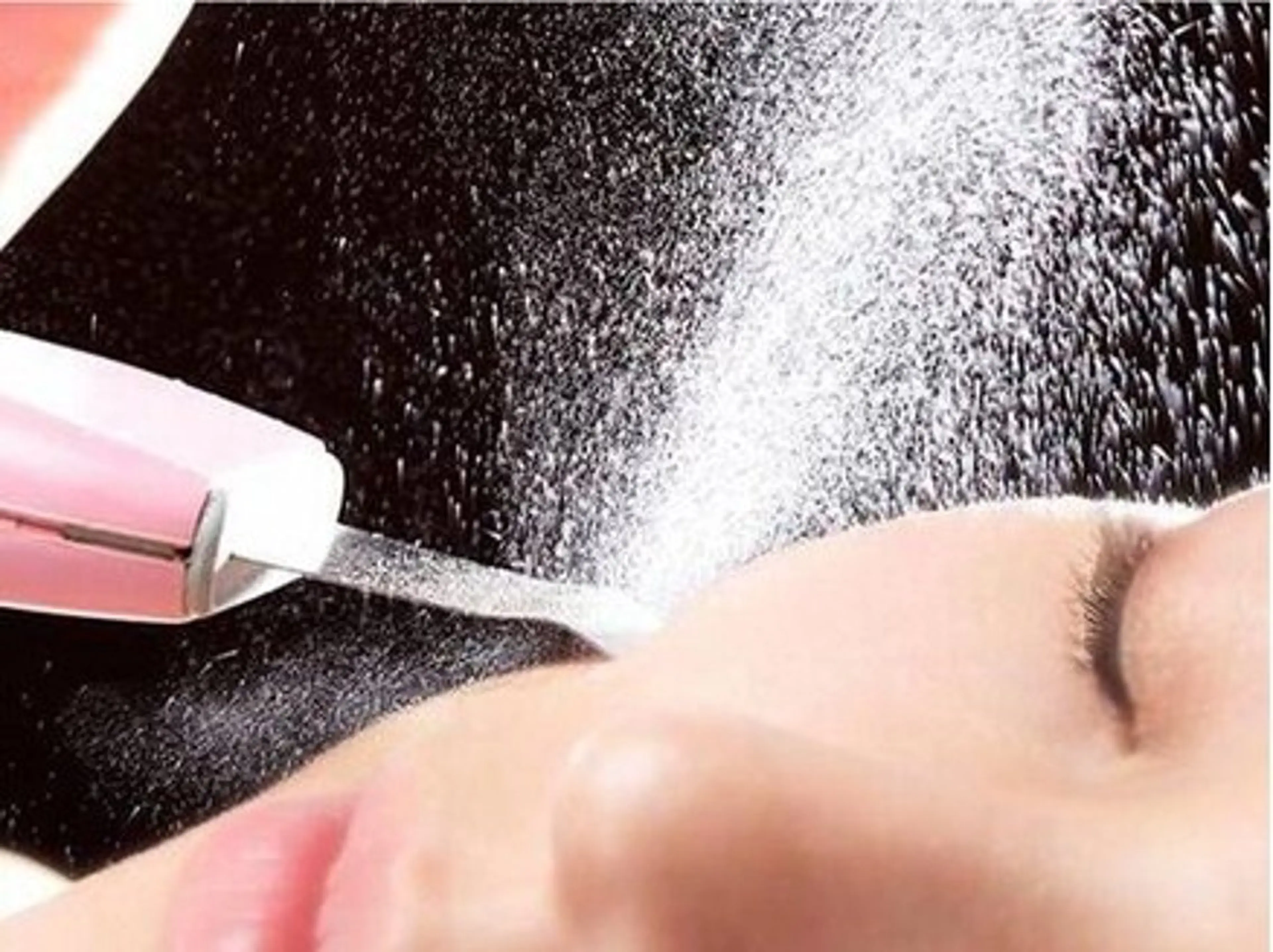 超音波振動で毛穴の中の汚れをごっそり浮かせて洗浄🚿《ダーマスクライバー》2回9900円の写真