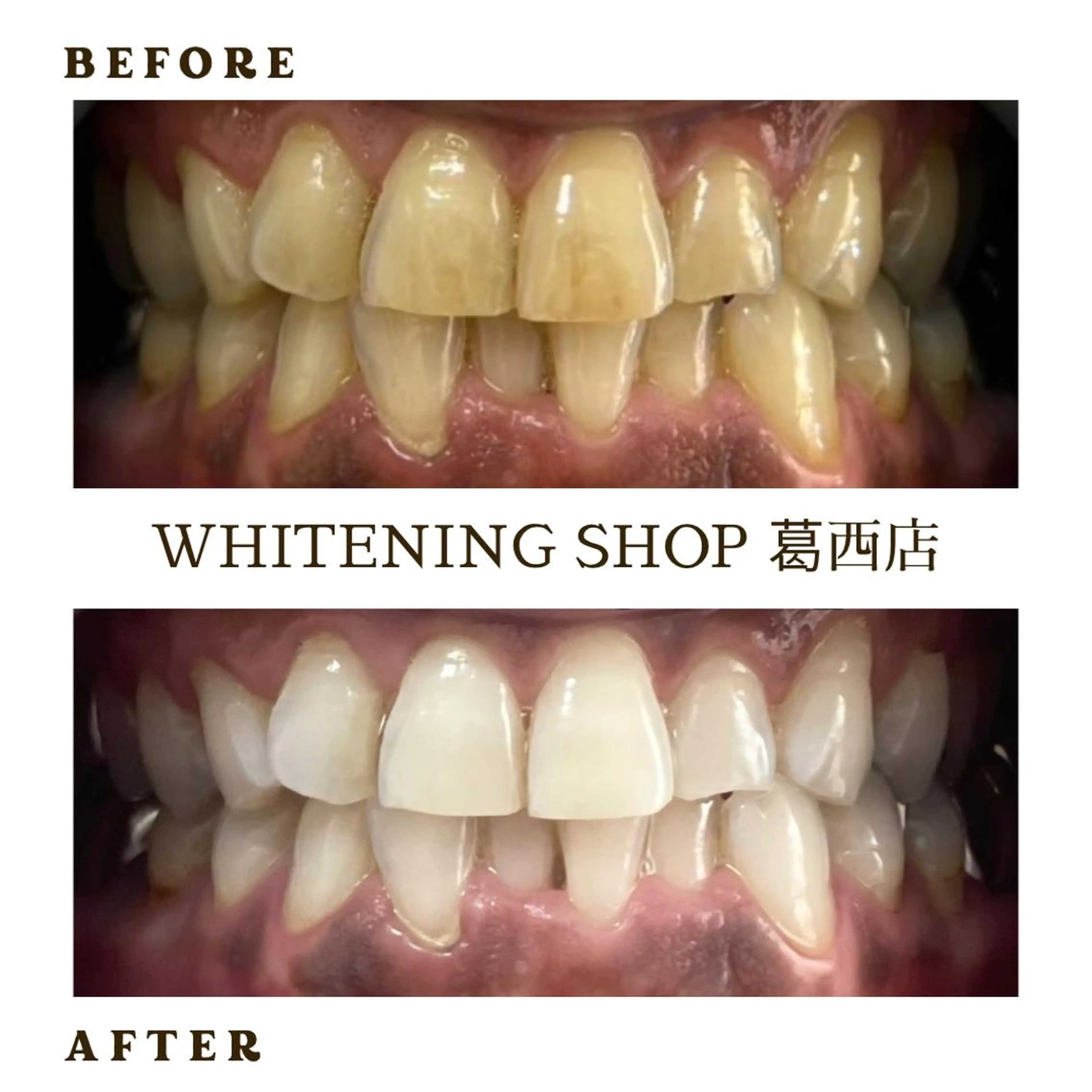 メンズ その他 ホワイトニング ショップ葛西店のその他イメージ