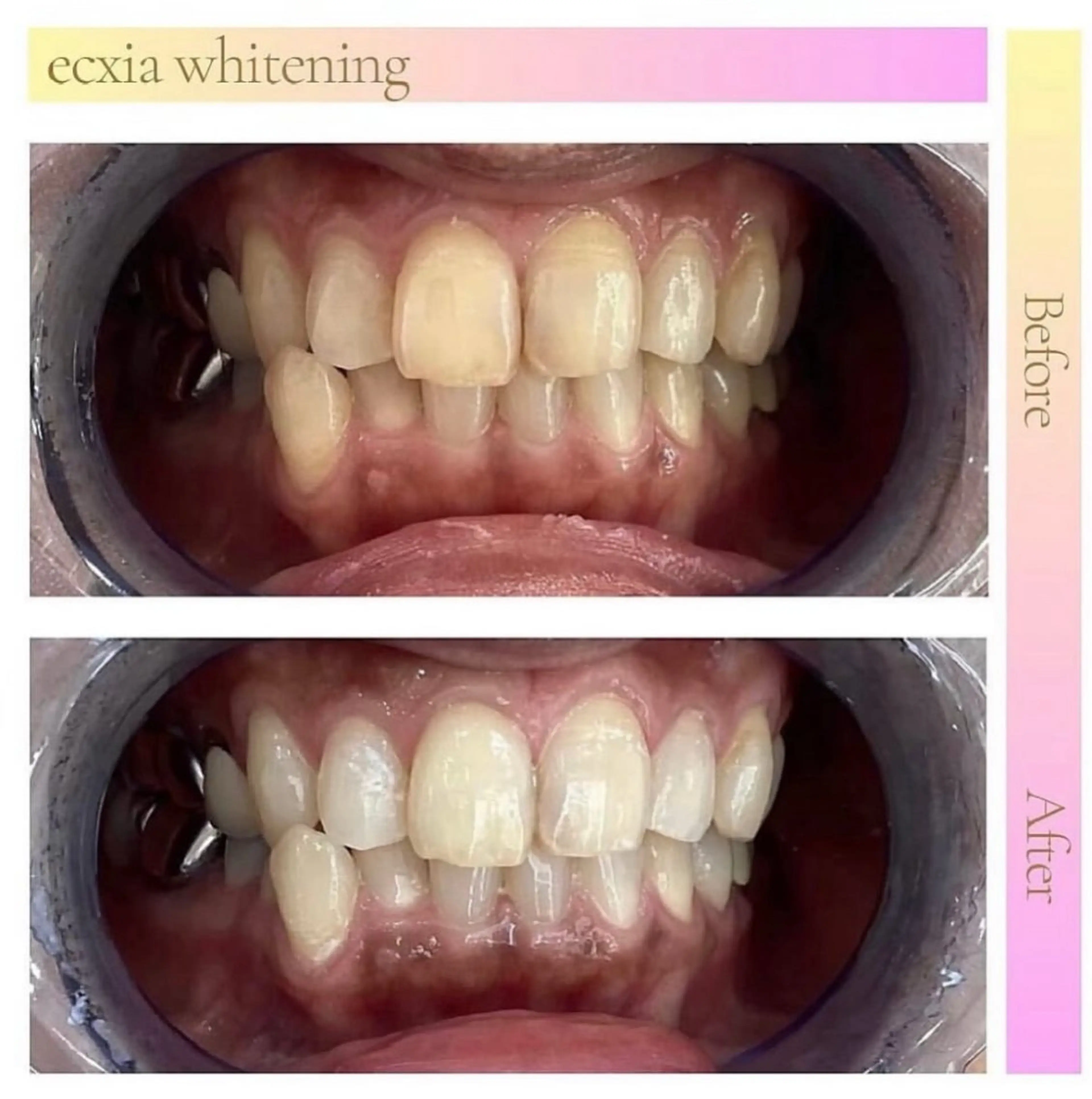 その他 セルフホワイトニングエクシア小山店所属・セルフホワイトニング エクシア小山店のその他イメージ