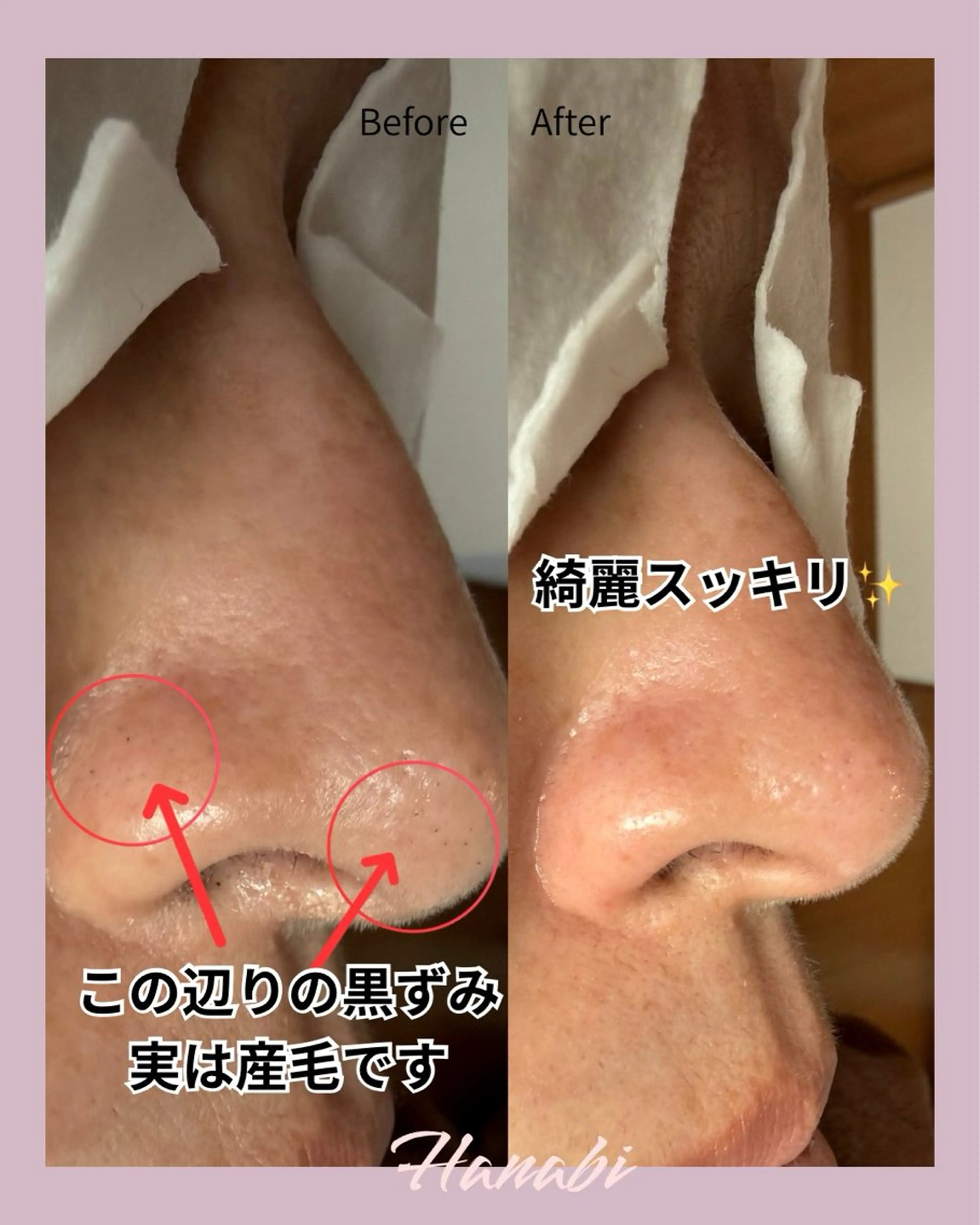 エステ 毛穴専門サロン Hanabiのエステ・リラクイメージ