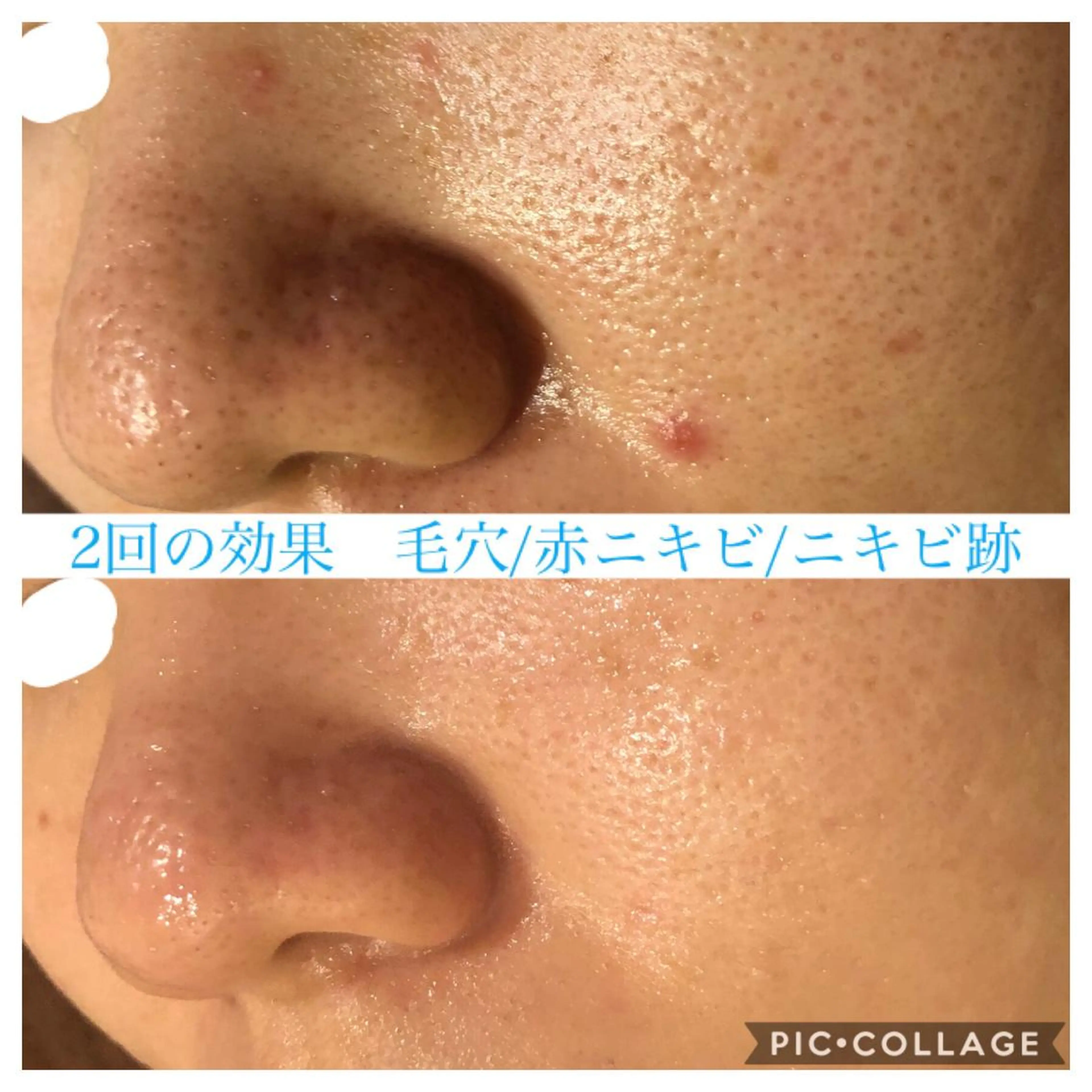 ロング カラー パーマ ヘアアレンジ キッズ ネイル マツエク・マツパ エステ リラク Ensor Clair所属・EnsorClair 代表　野口真央のエステ・リラクイメージ