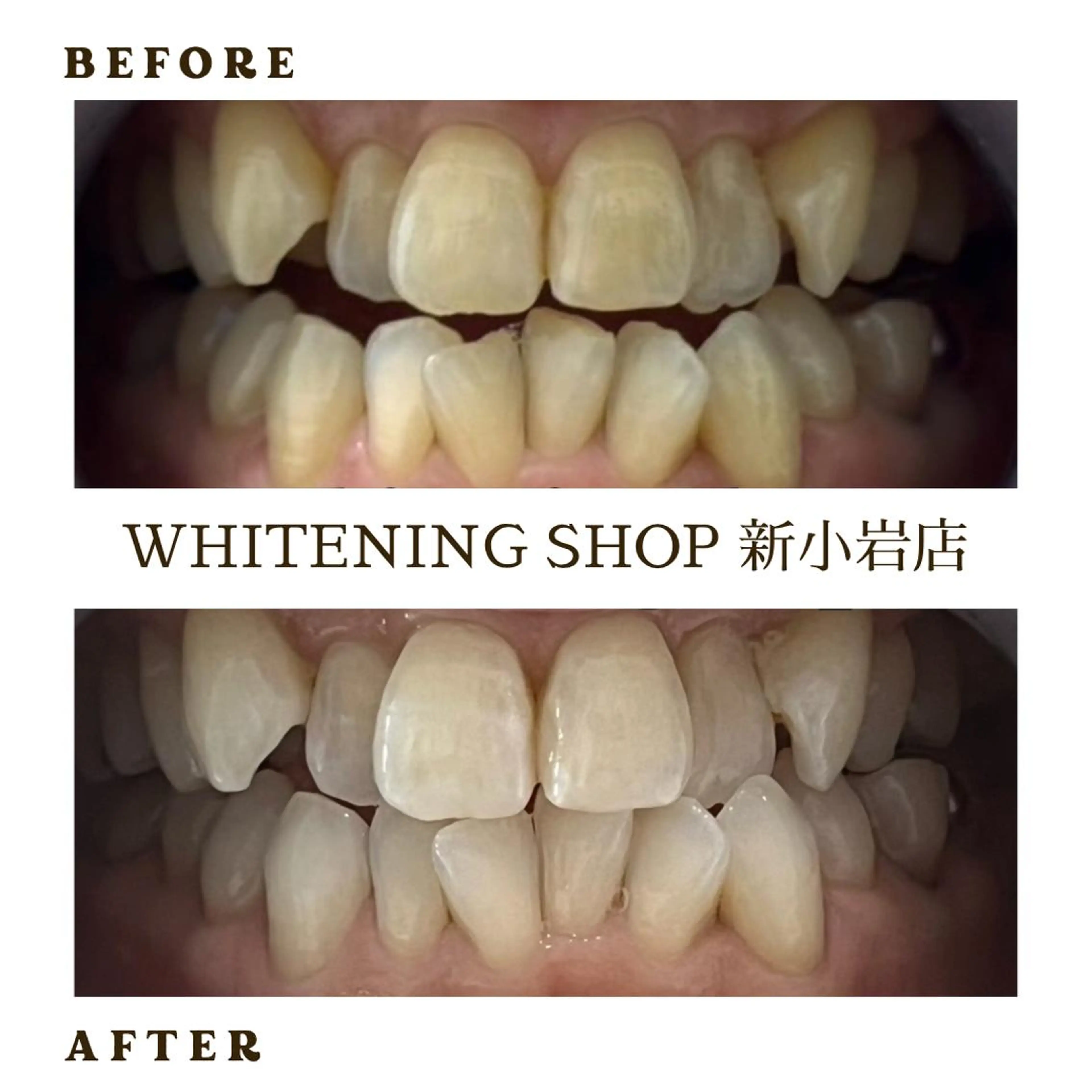 メンズ その他 ホワイトニング ショップ新小岩店のその他イメージ