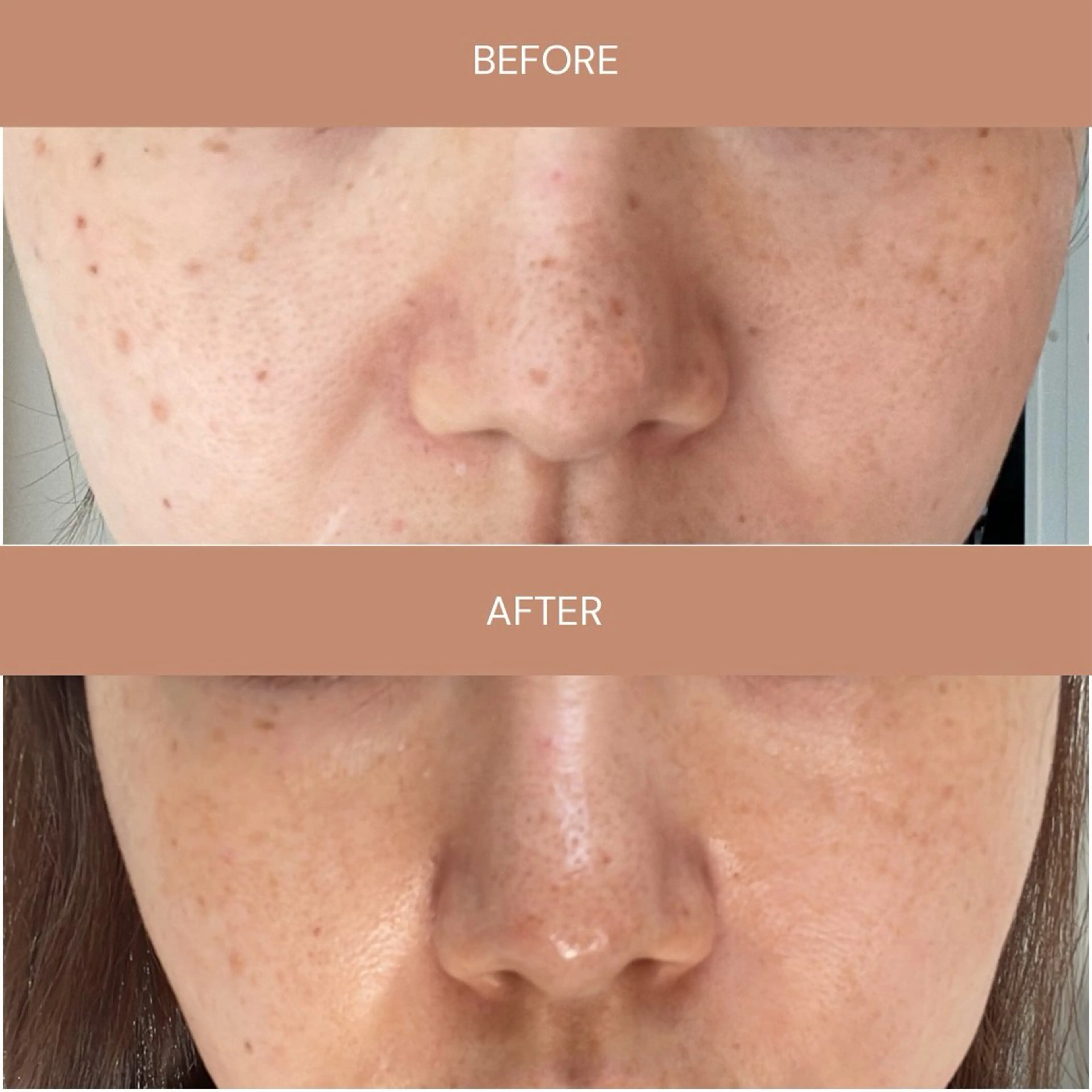 エステ 肌質改善エステ chiffonのエステ・リラクイメージ