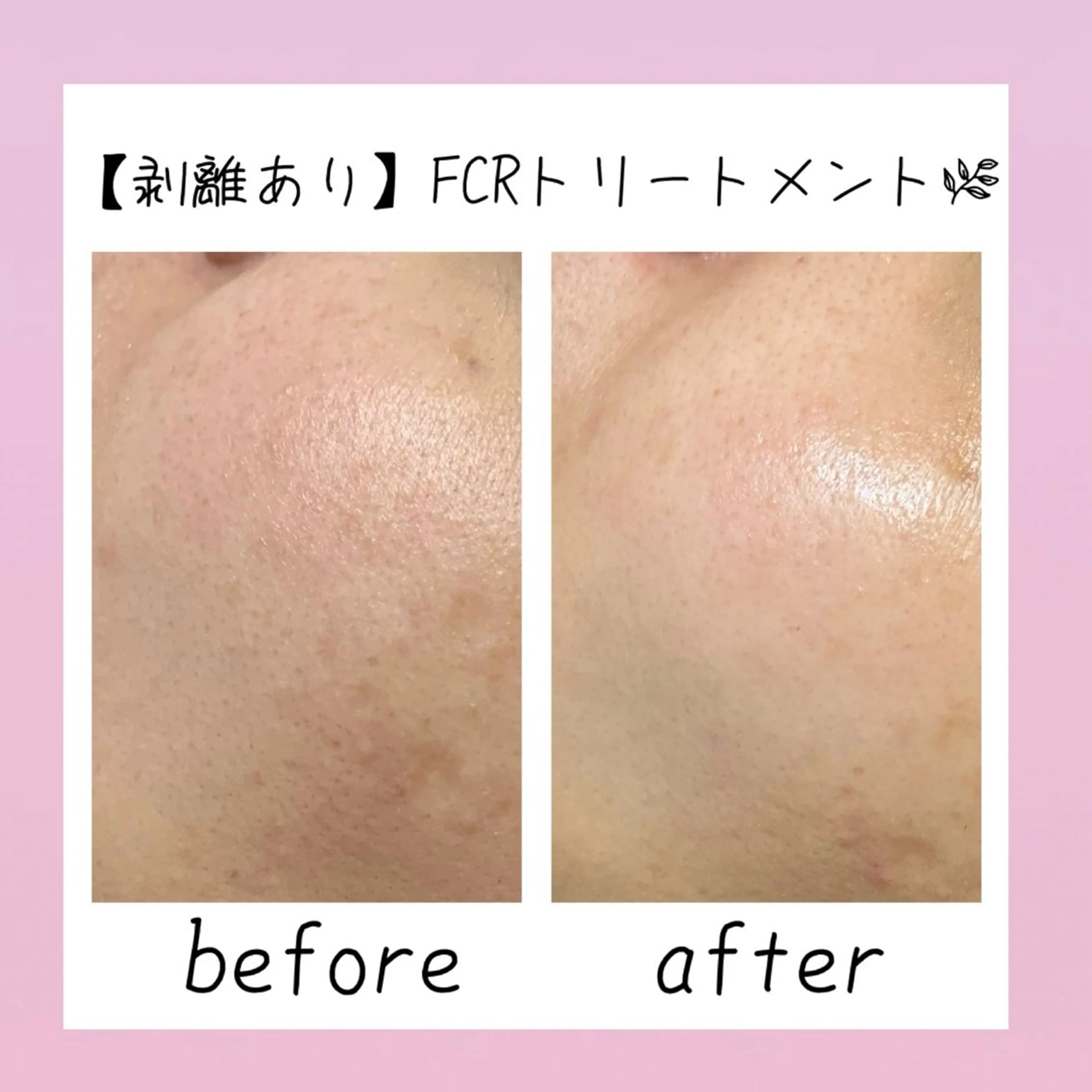 肌質改善Charme coco  増毛のエステ・リラクイメージ