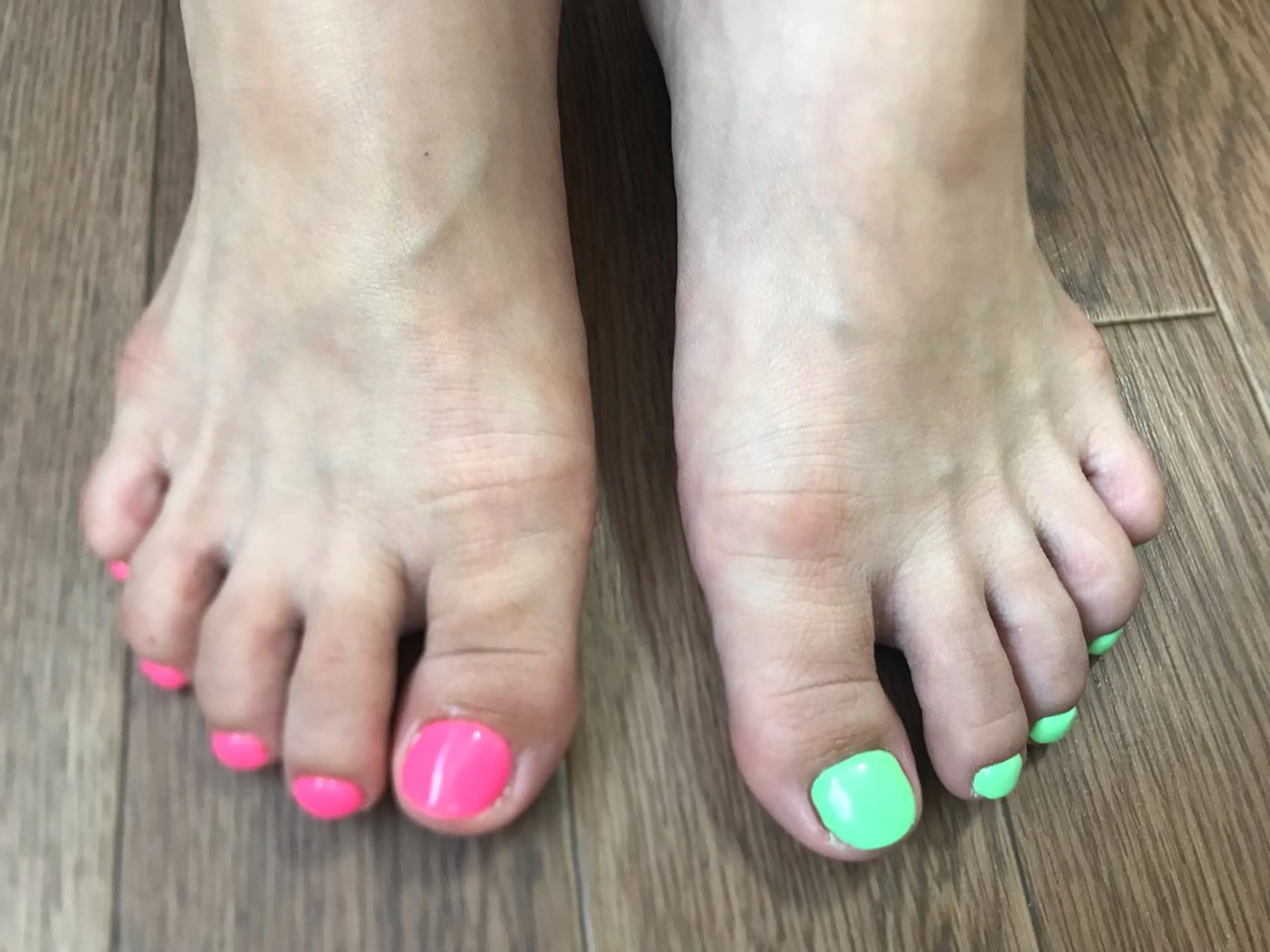 ネイル フットネイル Nailist Missaのネイルデザイン