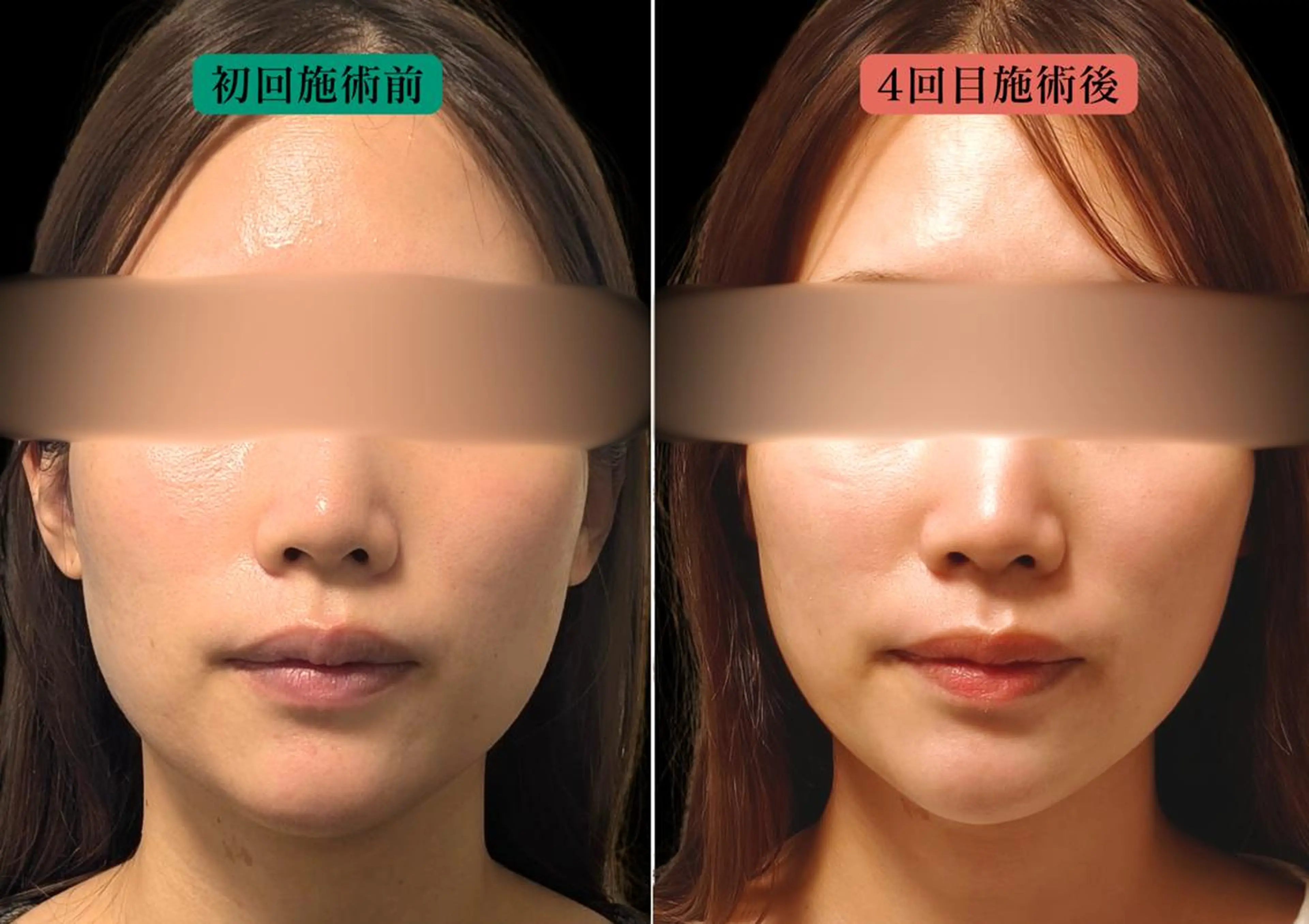 エステ リラク 美容とカラダの鍼灸 サロン やなけんのエステ・リラクイメージ