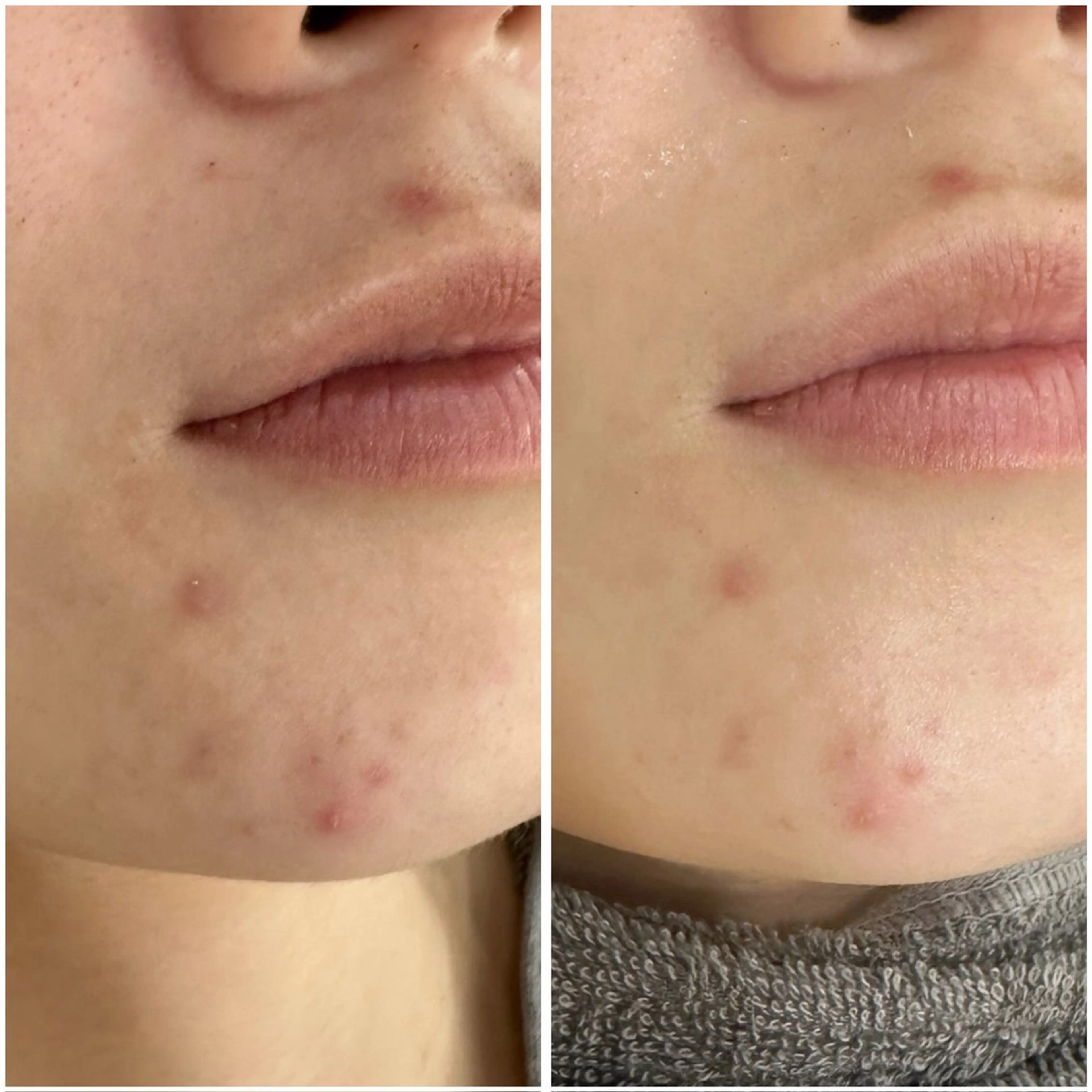 エステ リラク 艶肌デトックス🫧 Samiraのエステ・リラクイメージ