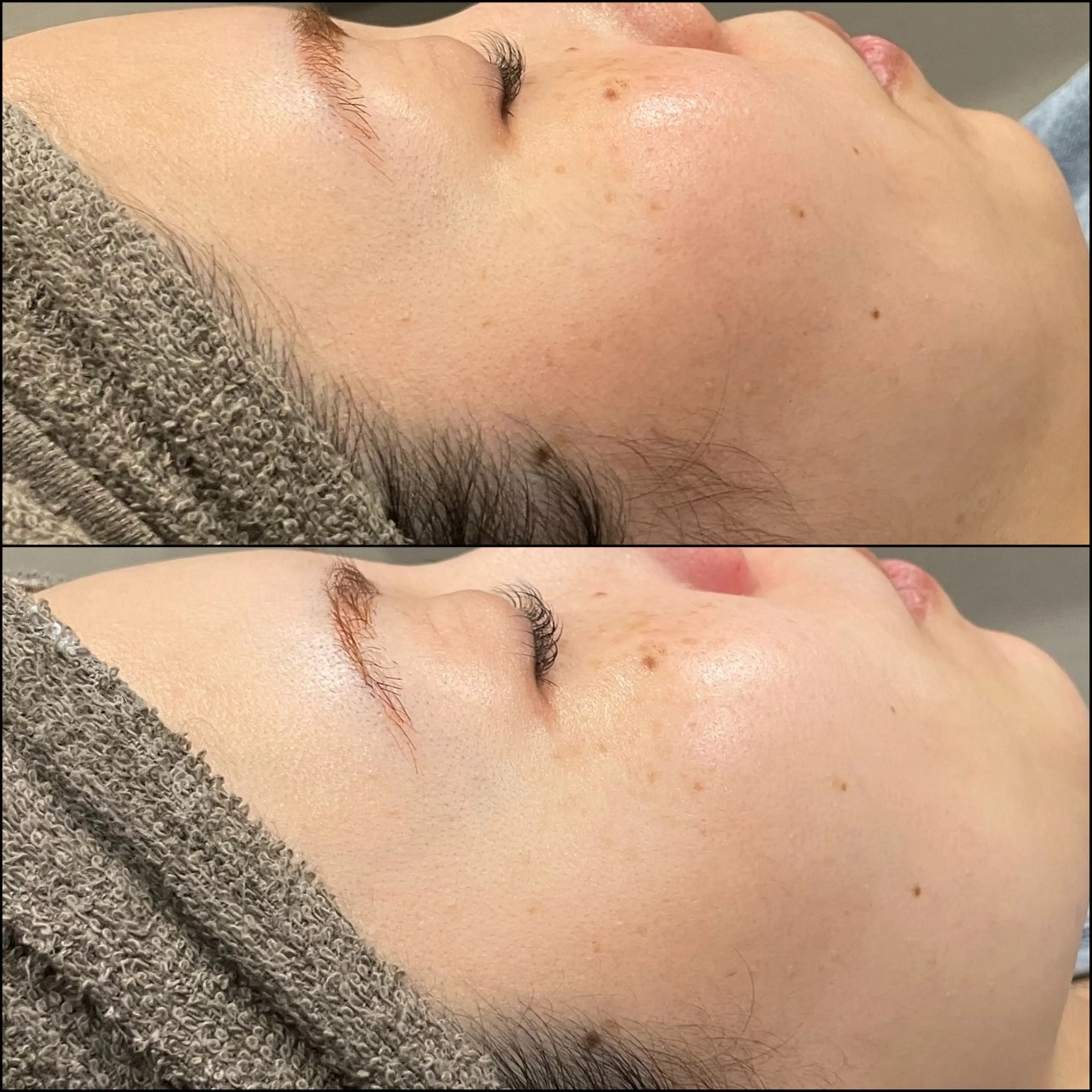 脱毛 LiZA エステティックサロンのエステ・リラクイメージ