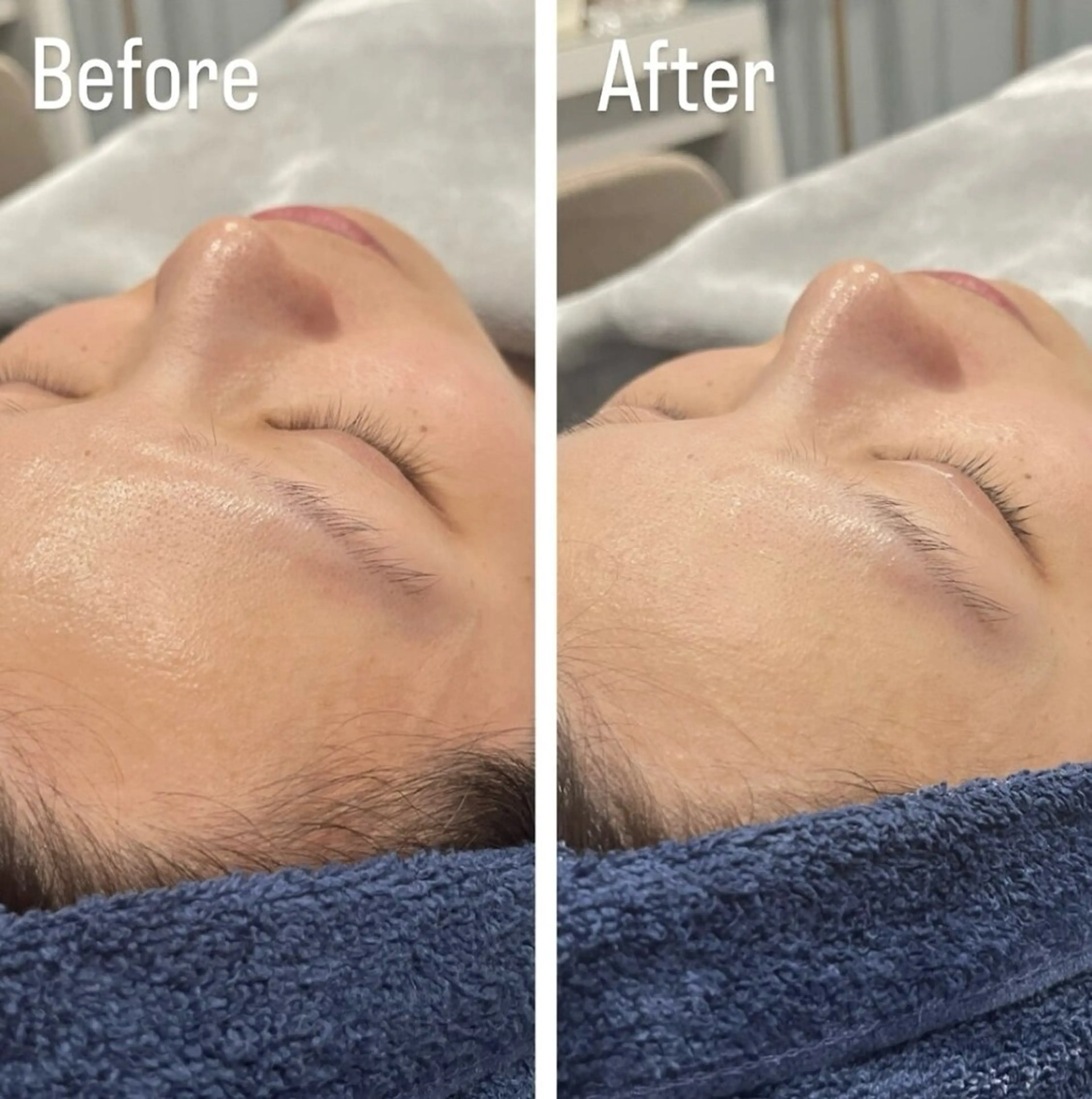 アンド ミルルのエステ・リラクイメージ