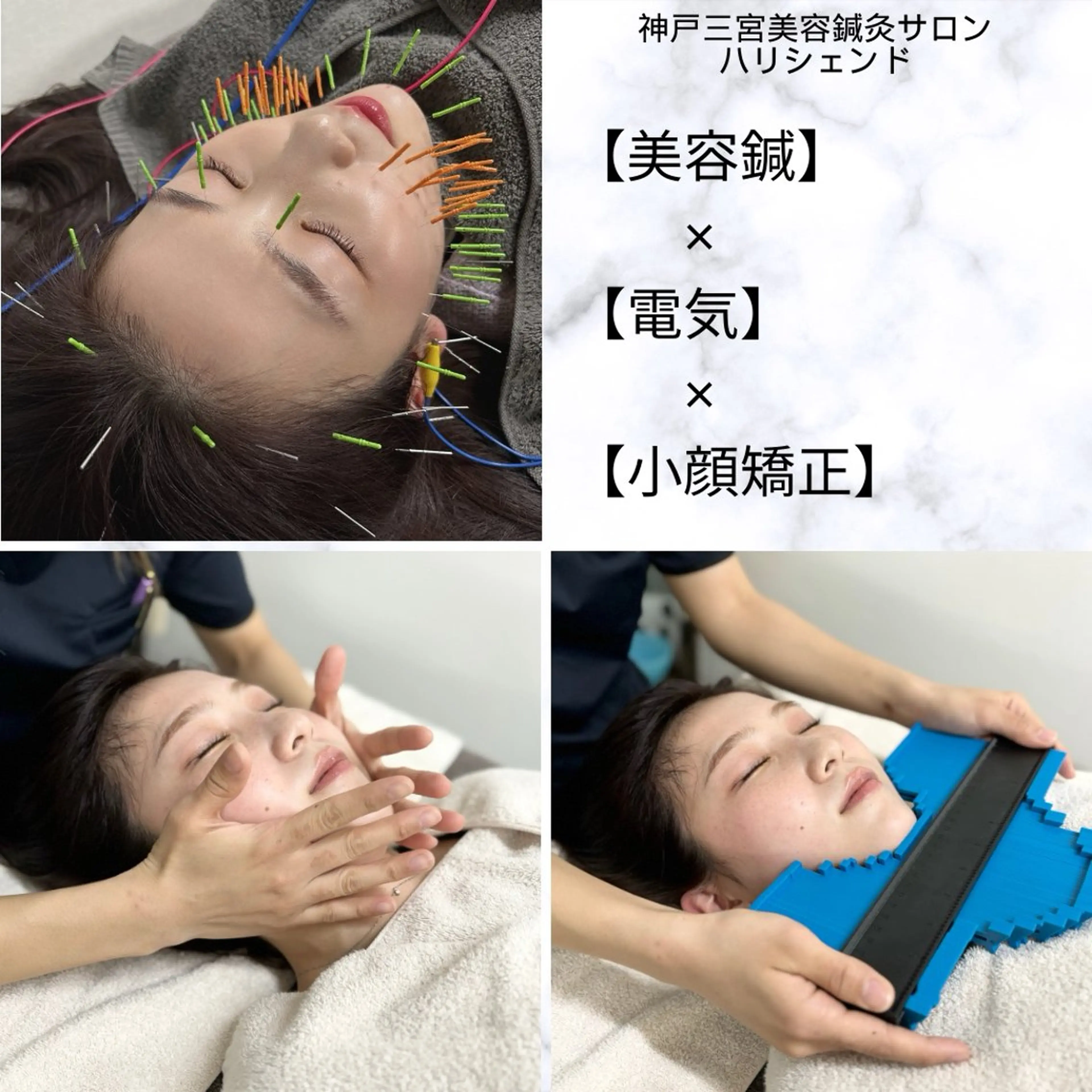 リフトアップ/むくみ改善【美容鍼】×【電気】×【小顔矯正】（むくみ、シワ、たるみが気になる方へ）約50分の写真