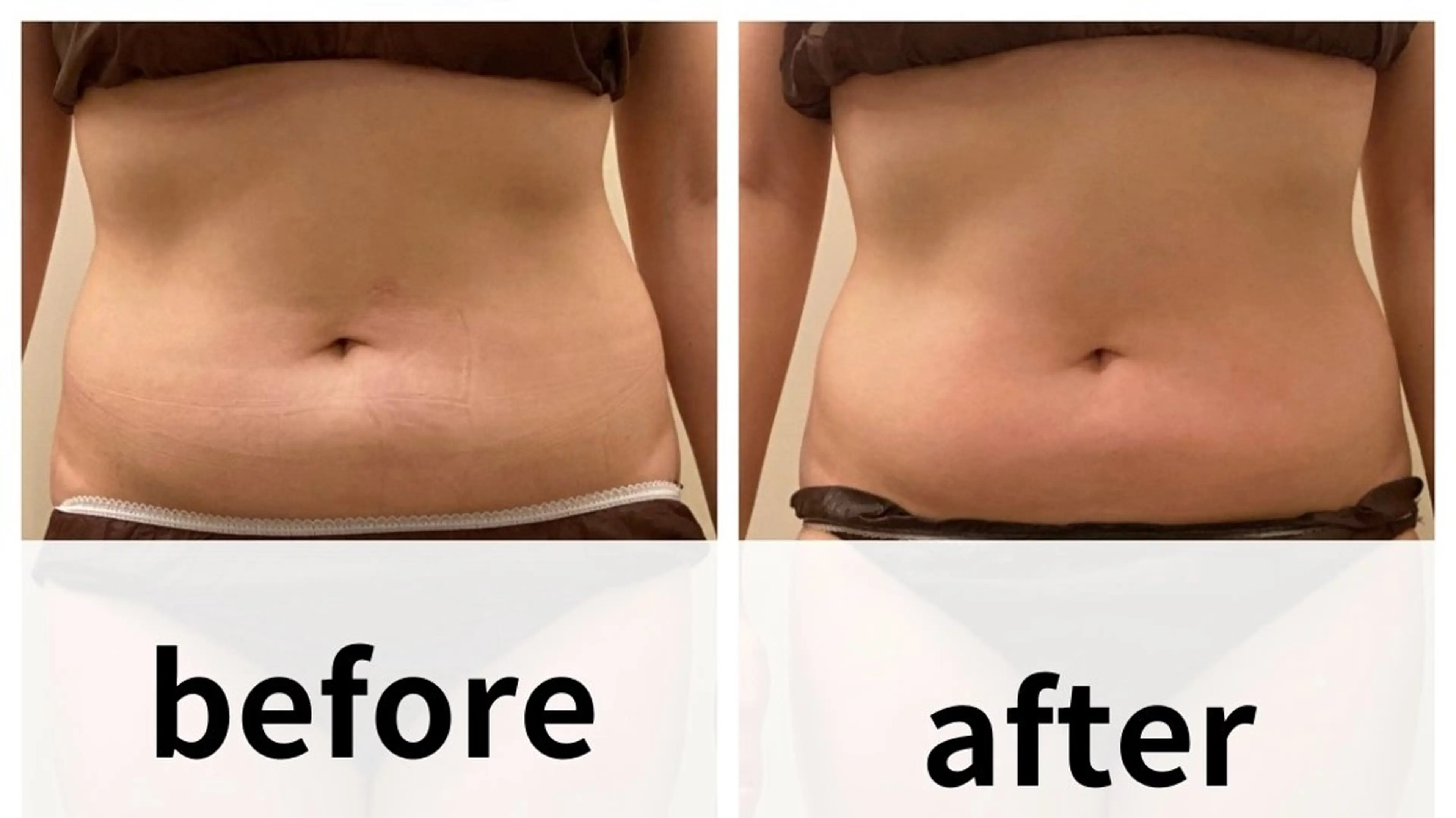 美容鍼/ヘッドスパ/ 💎さかもとのエステ・リラクイメージ