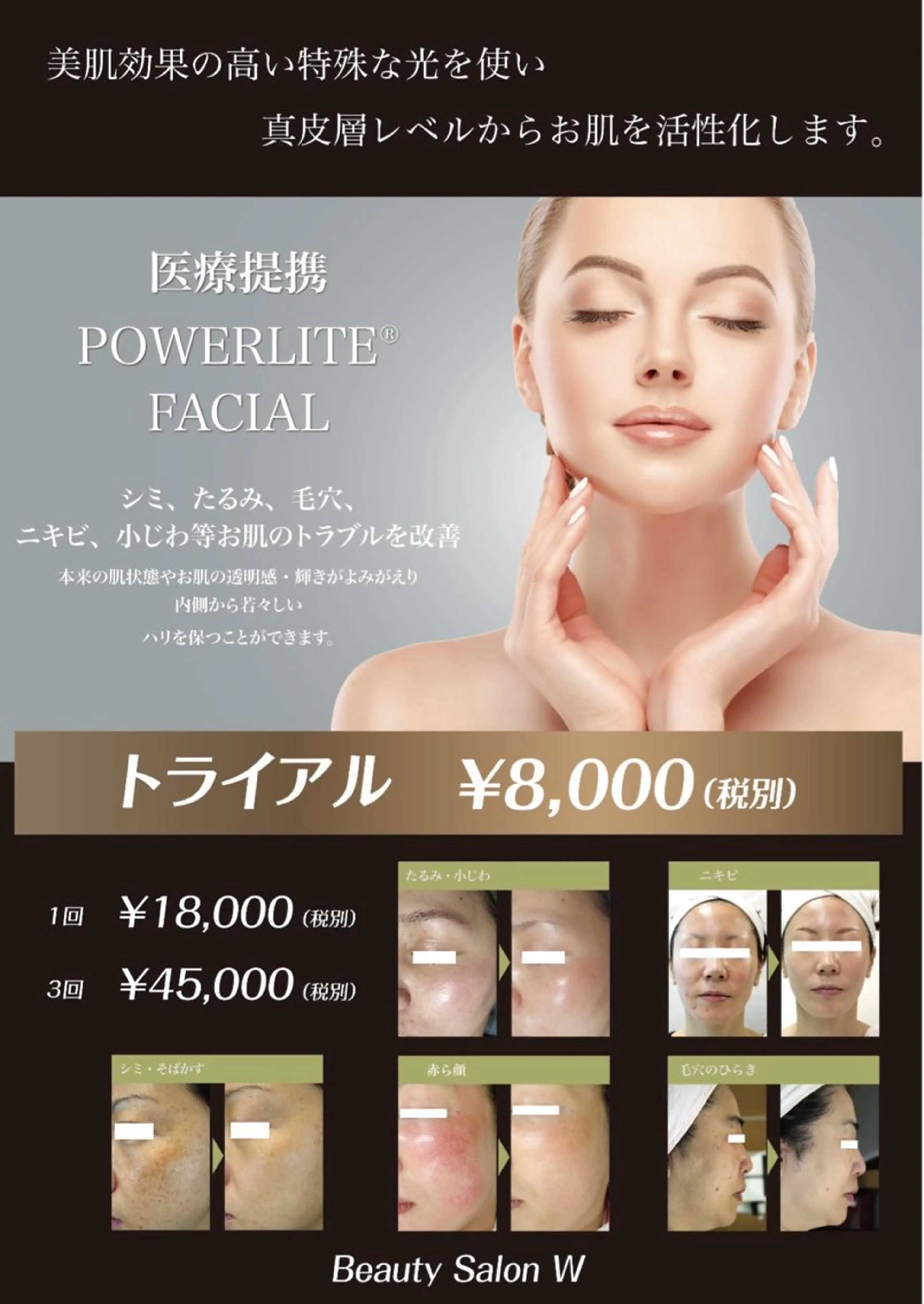 エステ 柏原 美咲のマツエク・マツパデザイン