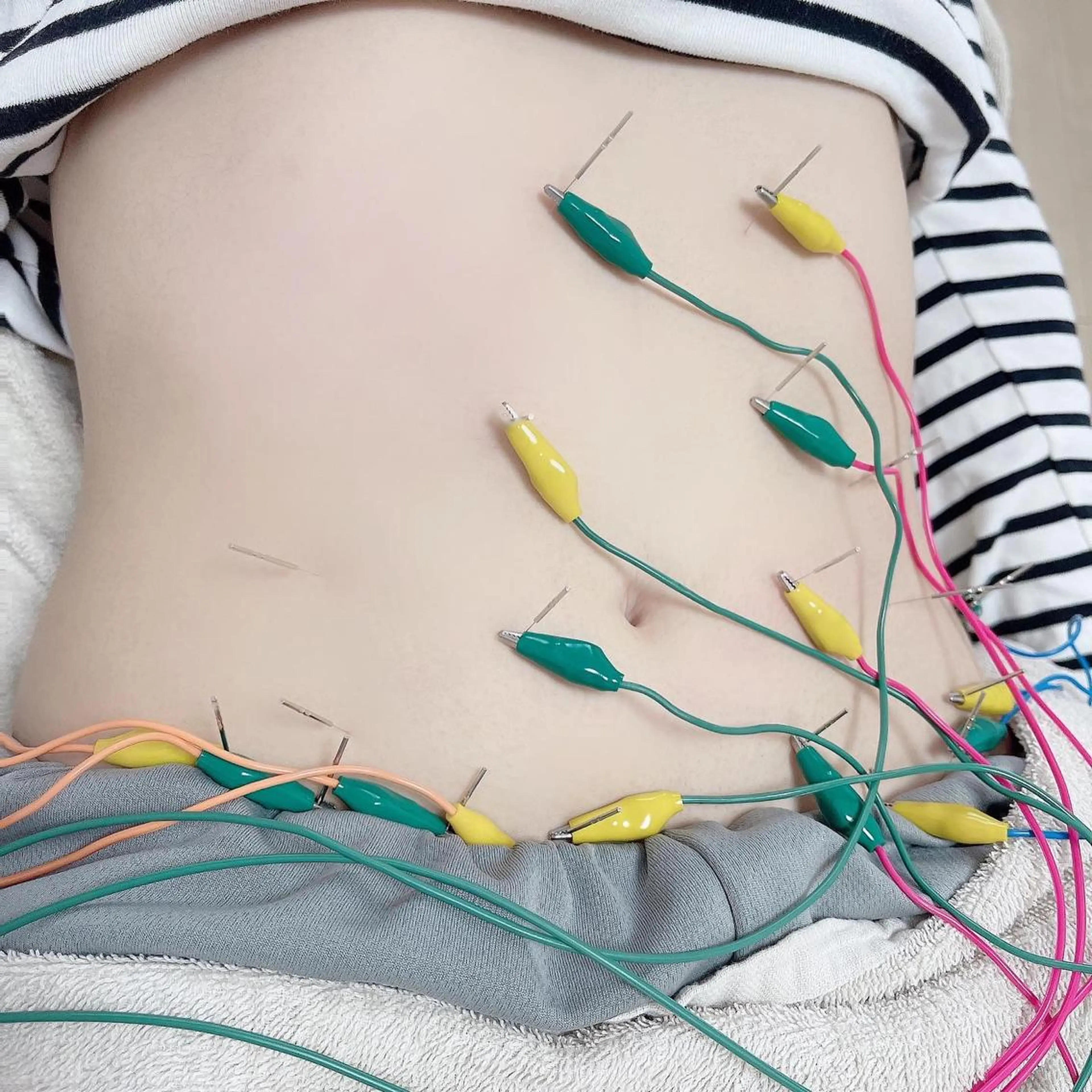 はりすたいる 鍼灸院のエステ・リラクイメージ