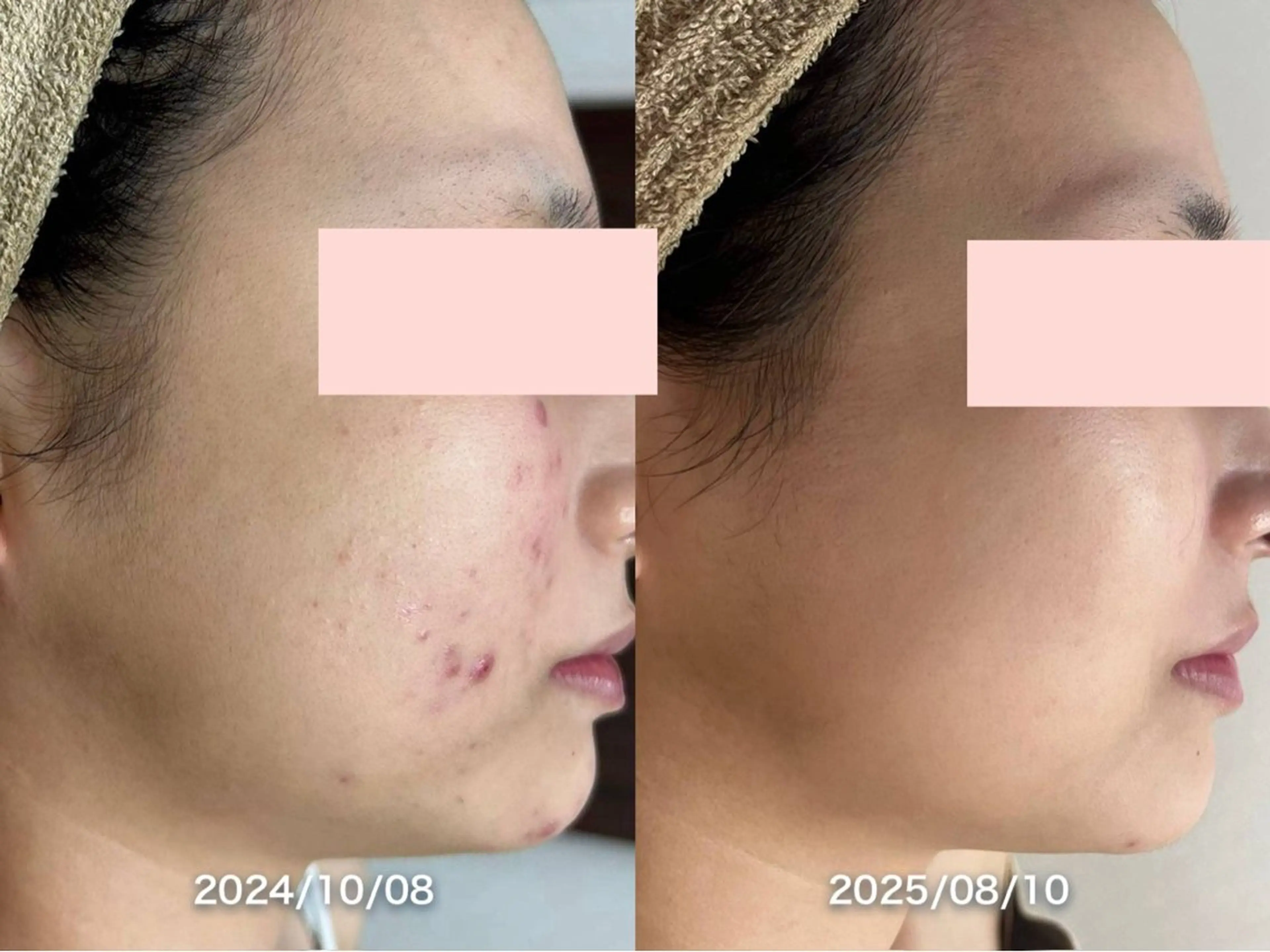 脱毛 【美肌専門 脱毛】 サロンドジェシカのエステ・リラクイメージ