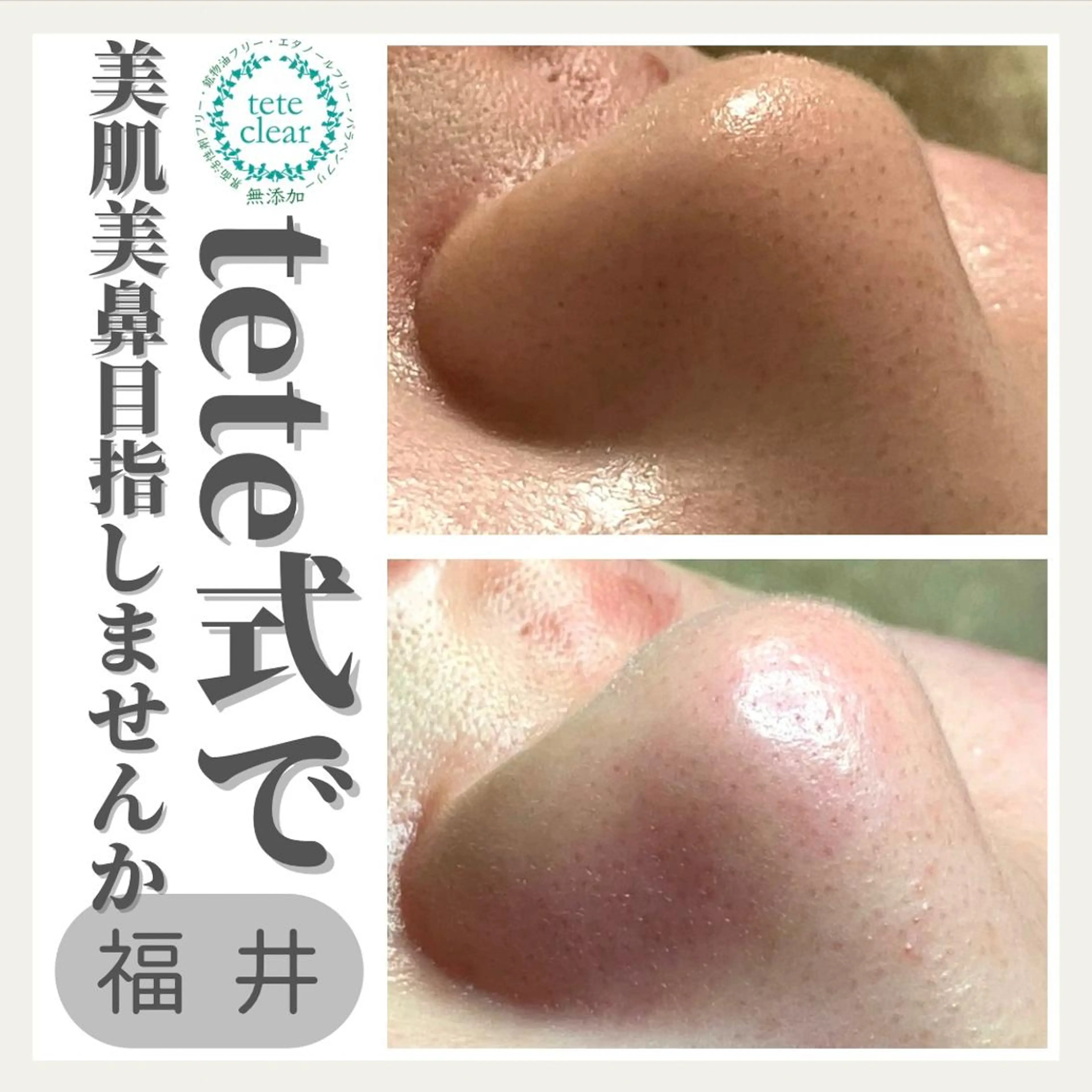 毛穴肌質ケアサロン Yourmeユアミーのエステ・リラクイメージ