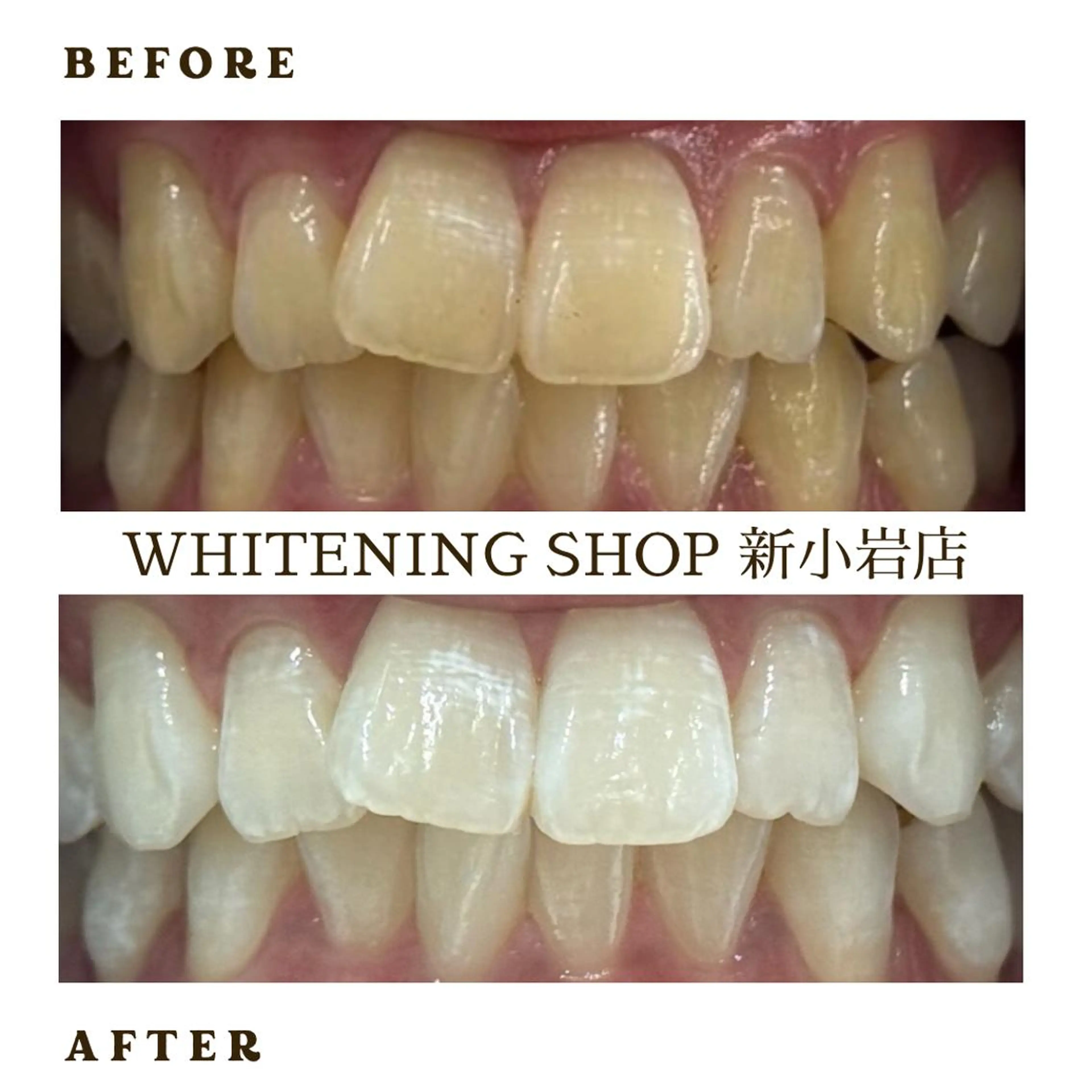 メンズ その他 ホワイトニング ショップ新小岩店のその他イメージ