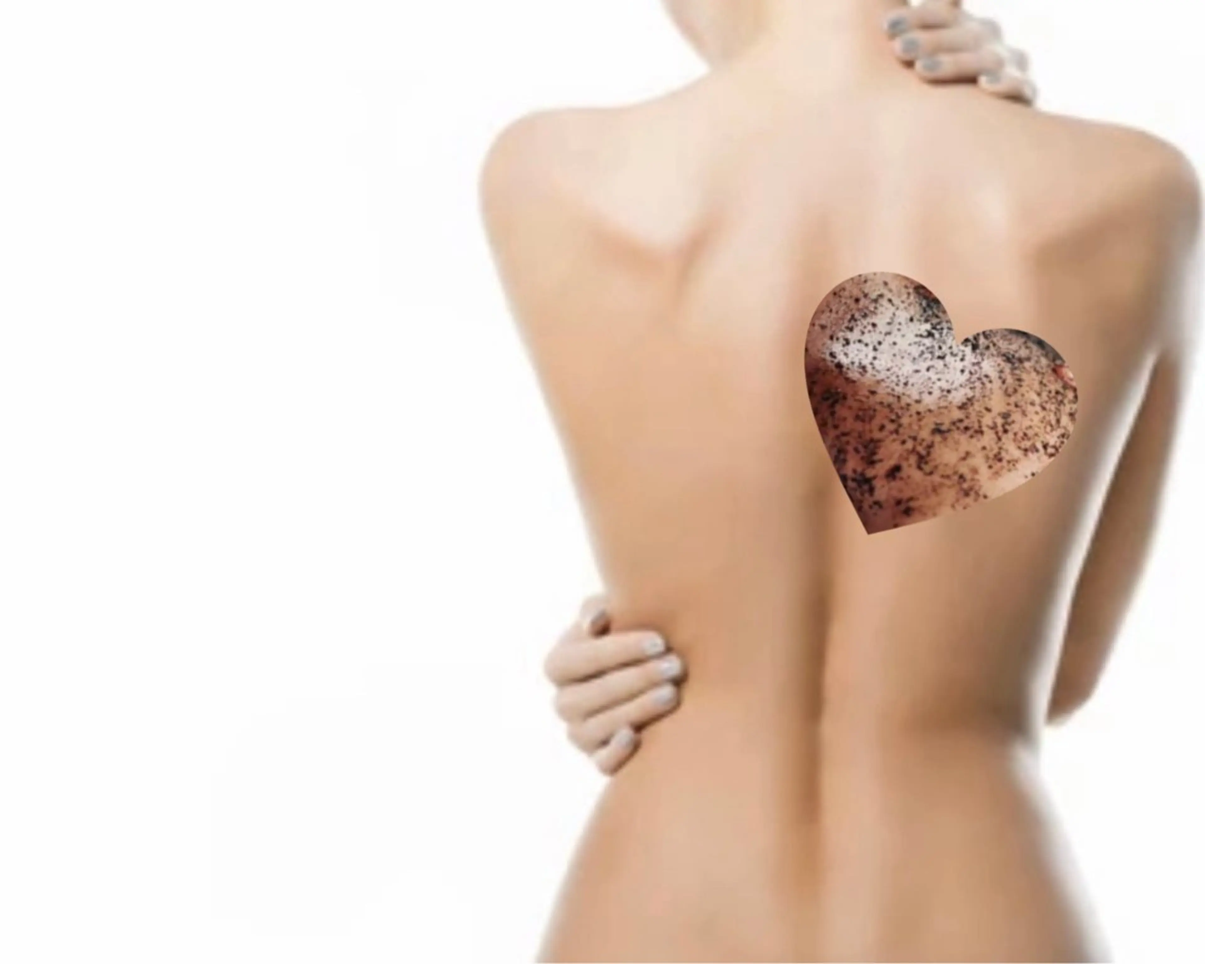 相談して決めたい方向けクーポン♪(ボディ)★ダウンタイムありorなしの写真