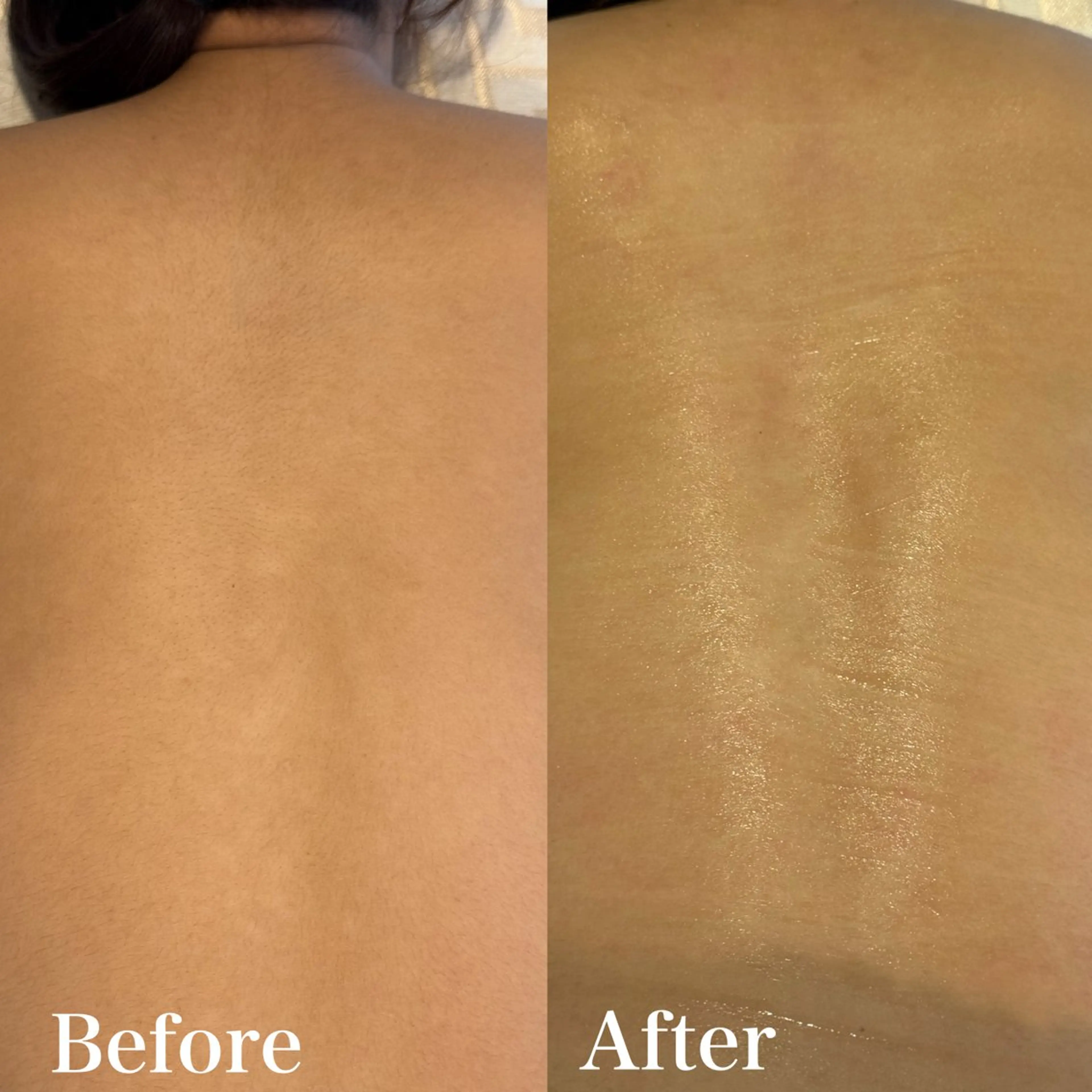 脱毛 wax脱毛専門店 ハイラントのエステ・リラクイメージ