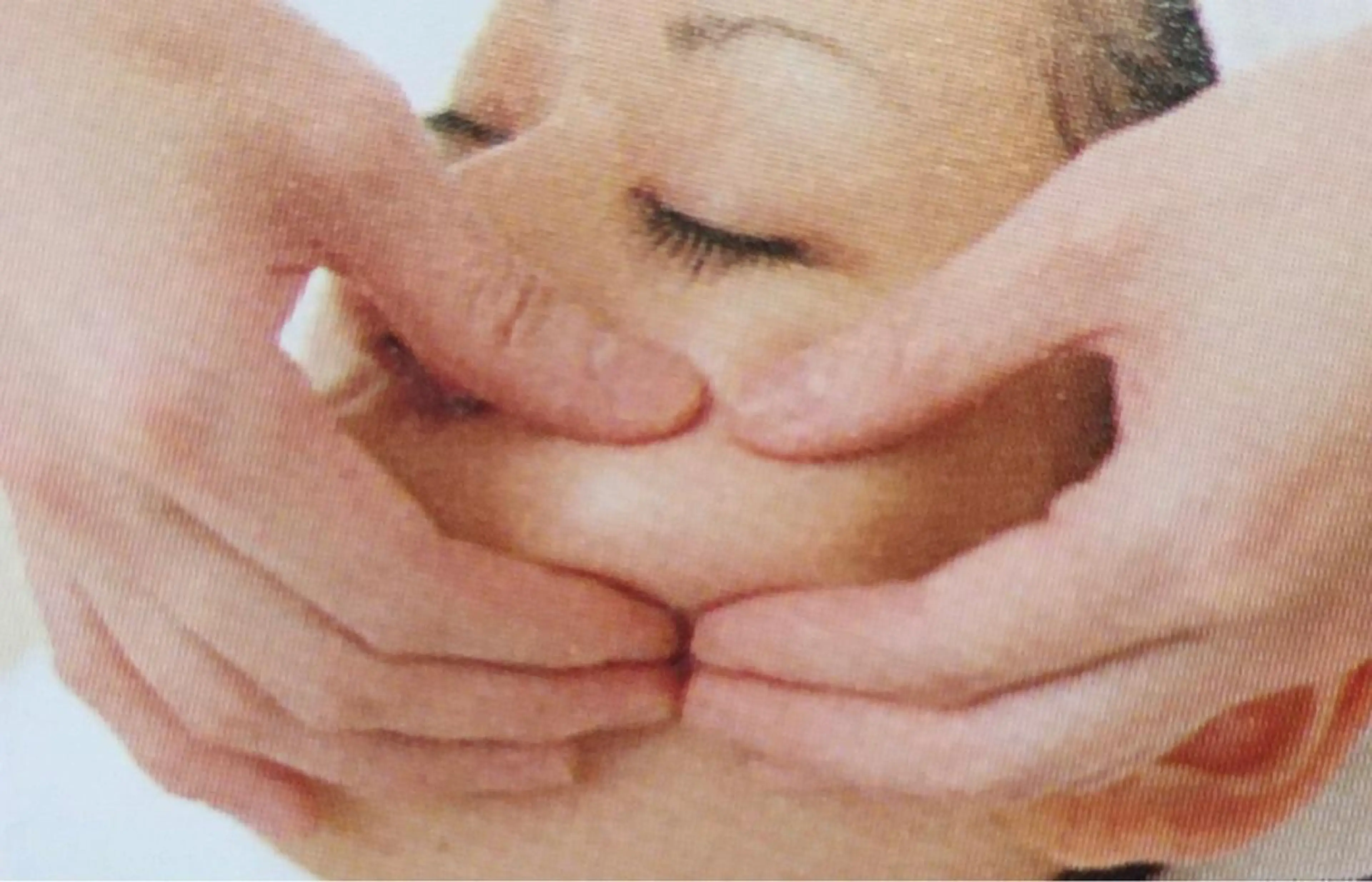 急なイベント前など大事な時に❣️造形エステの写真