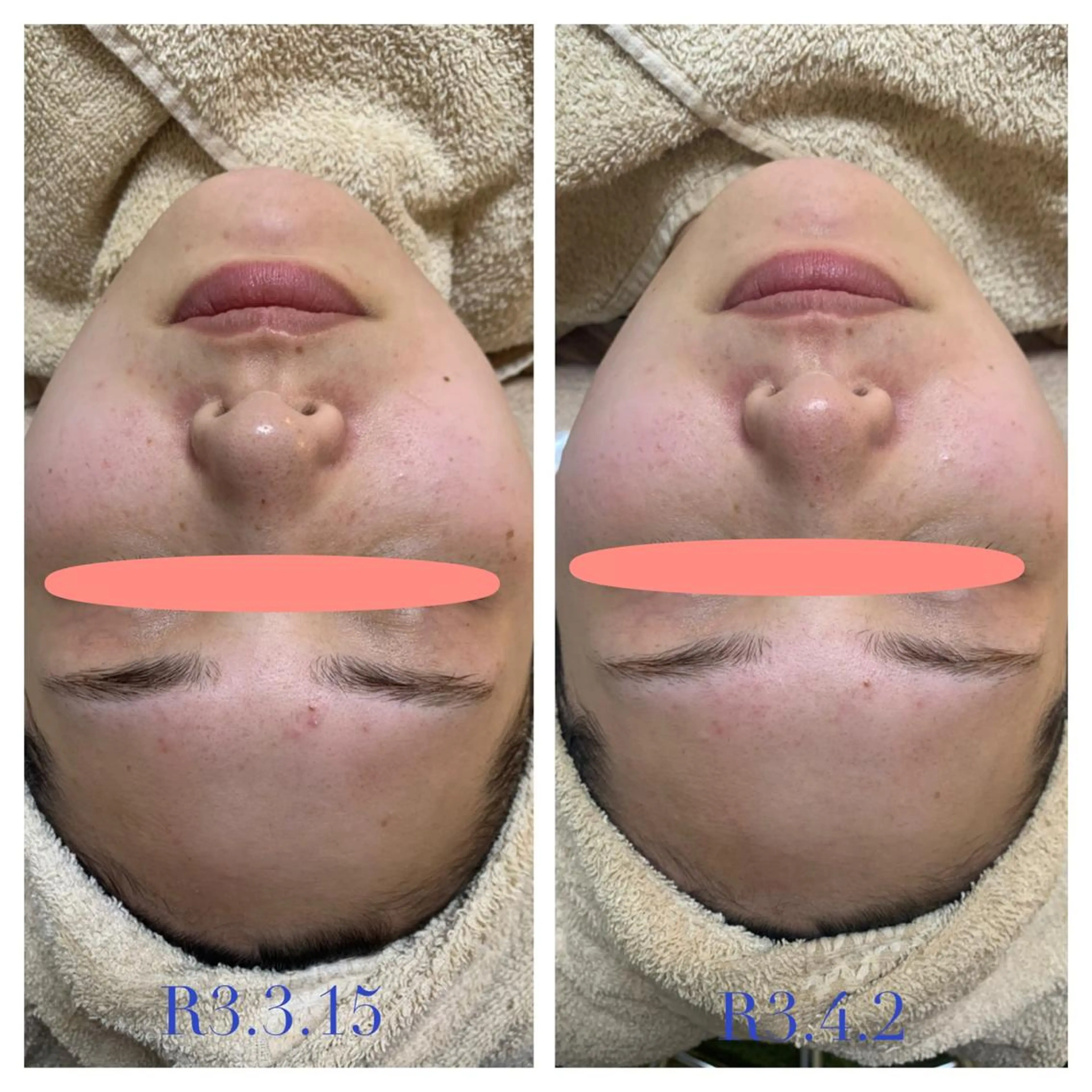 エステ エステティック Nanagiのエステ・リラクイメージ