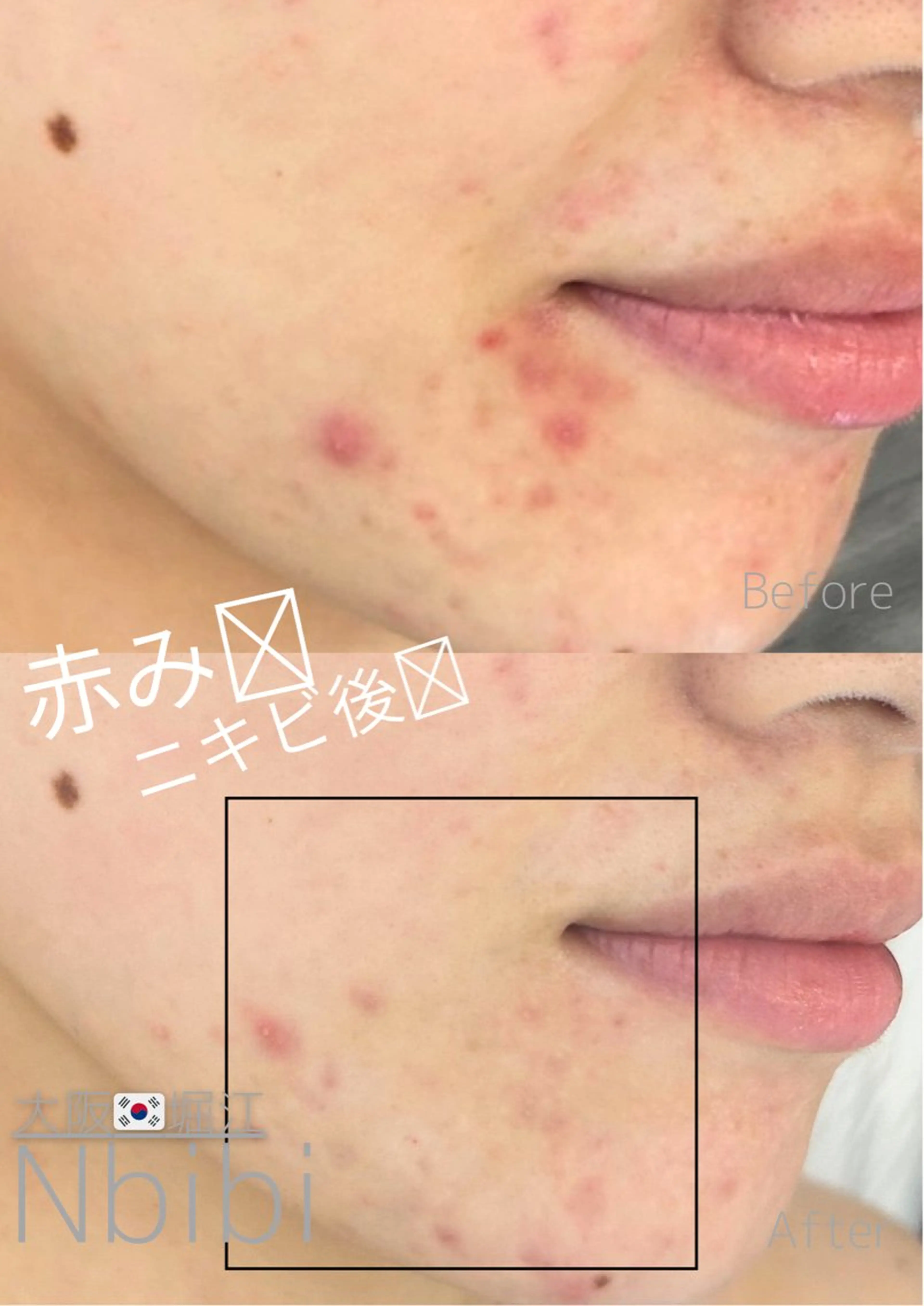 エステ 韓国🇰🇷価格 サロン_Nbibiのエステ・リラクイメージ