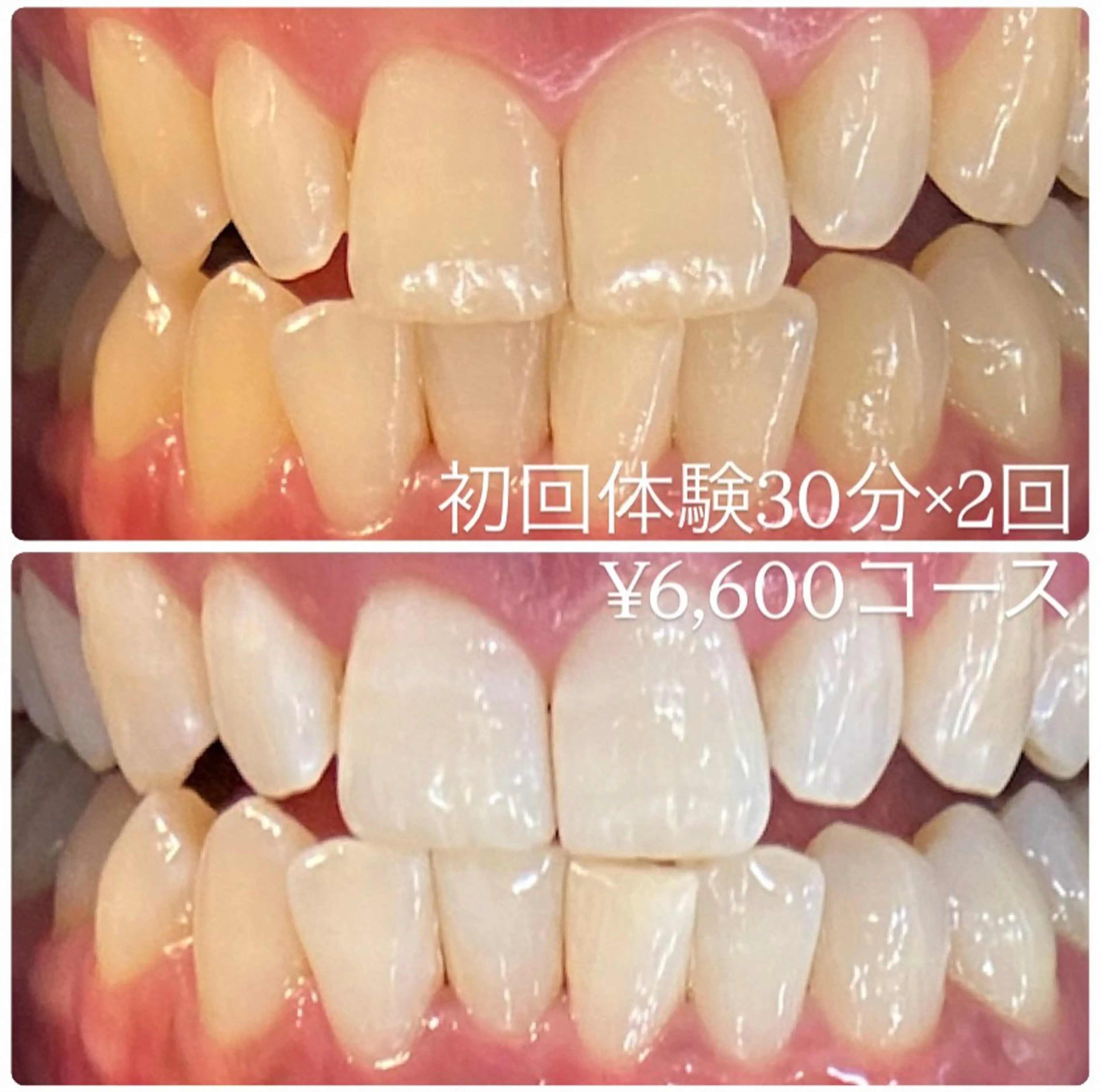 PLATINUM Beauty 横浜店所属・ホワイトニングルーム 横浜店のその他イメージ