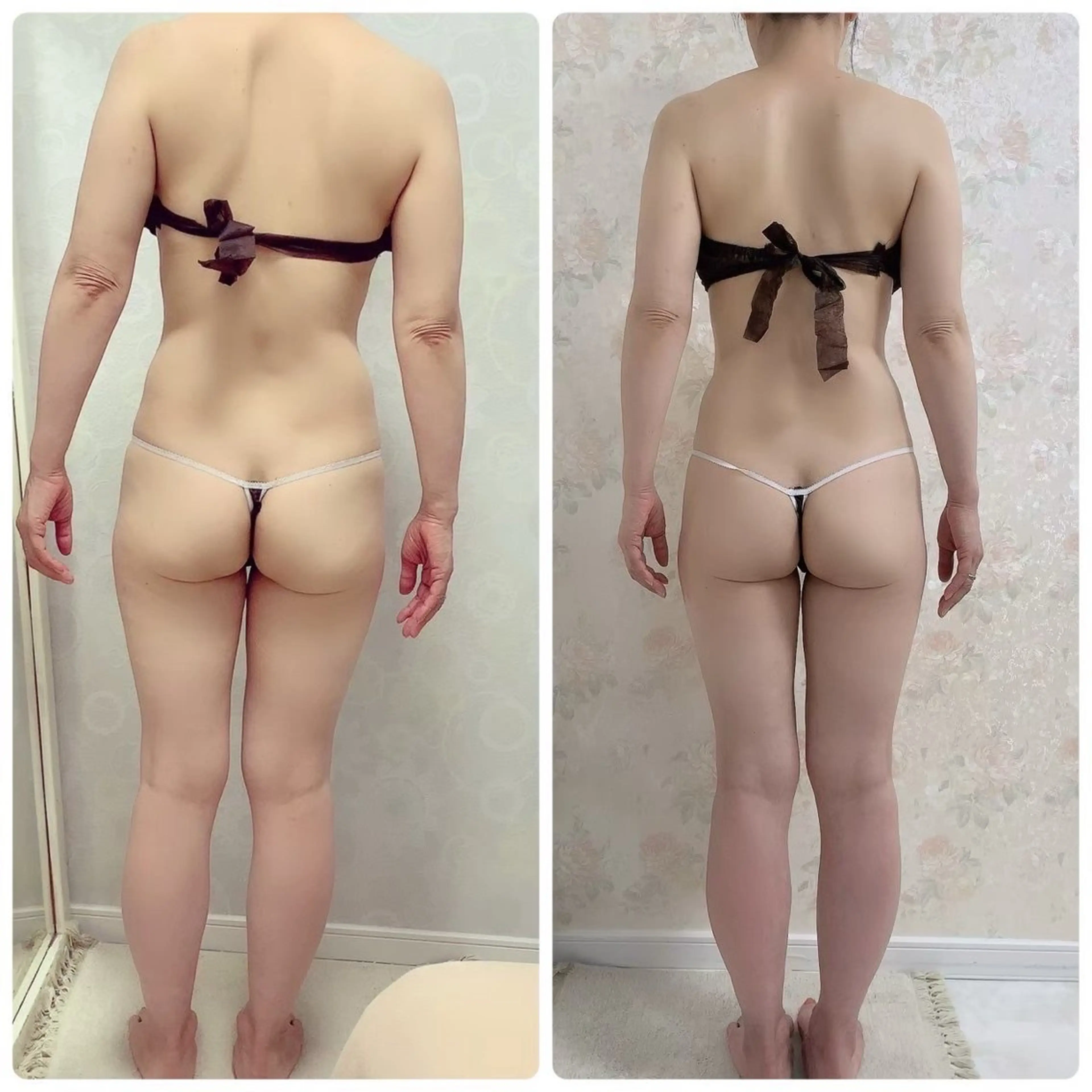 【お試し】全身激変！フルボディ🙋‍♀️【痩身エステ:全身1回コース】の写真