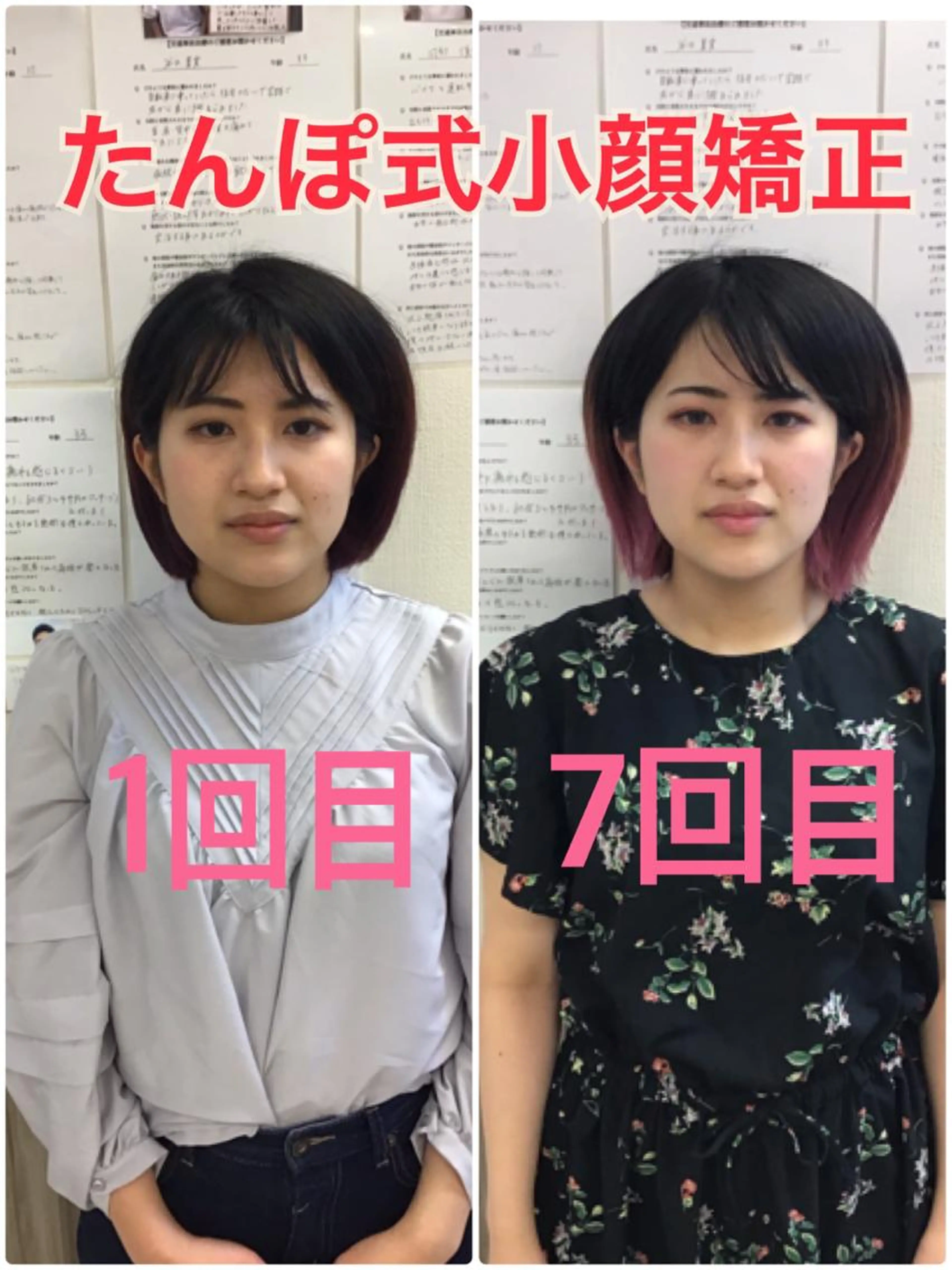 【モニター残り1名】全身プロポーション矯正✖️本格小顔矯正の写真