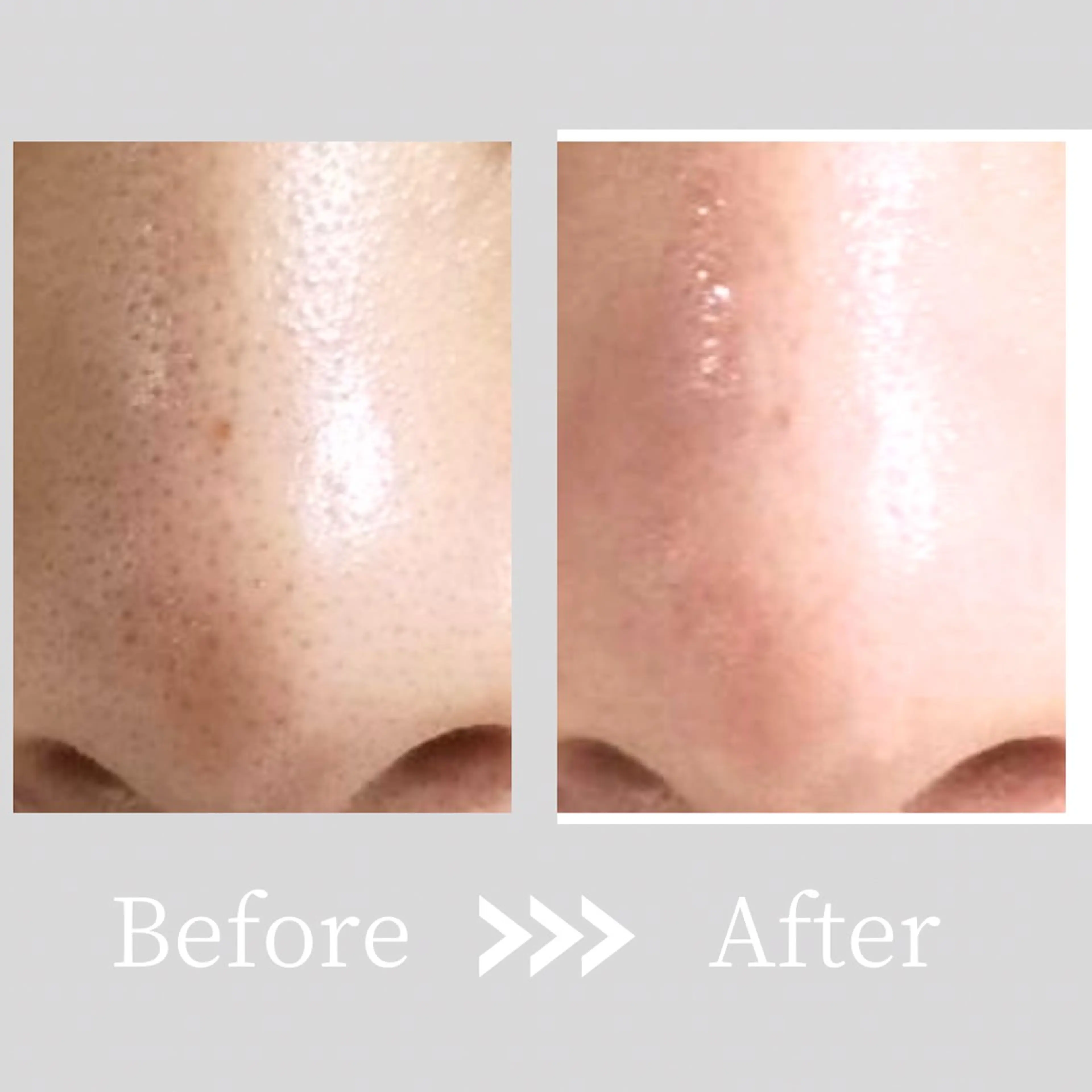 小顔・ツルツル素肌 ハリステリアのエステ・リラクイメージ