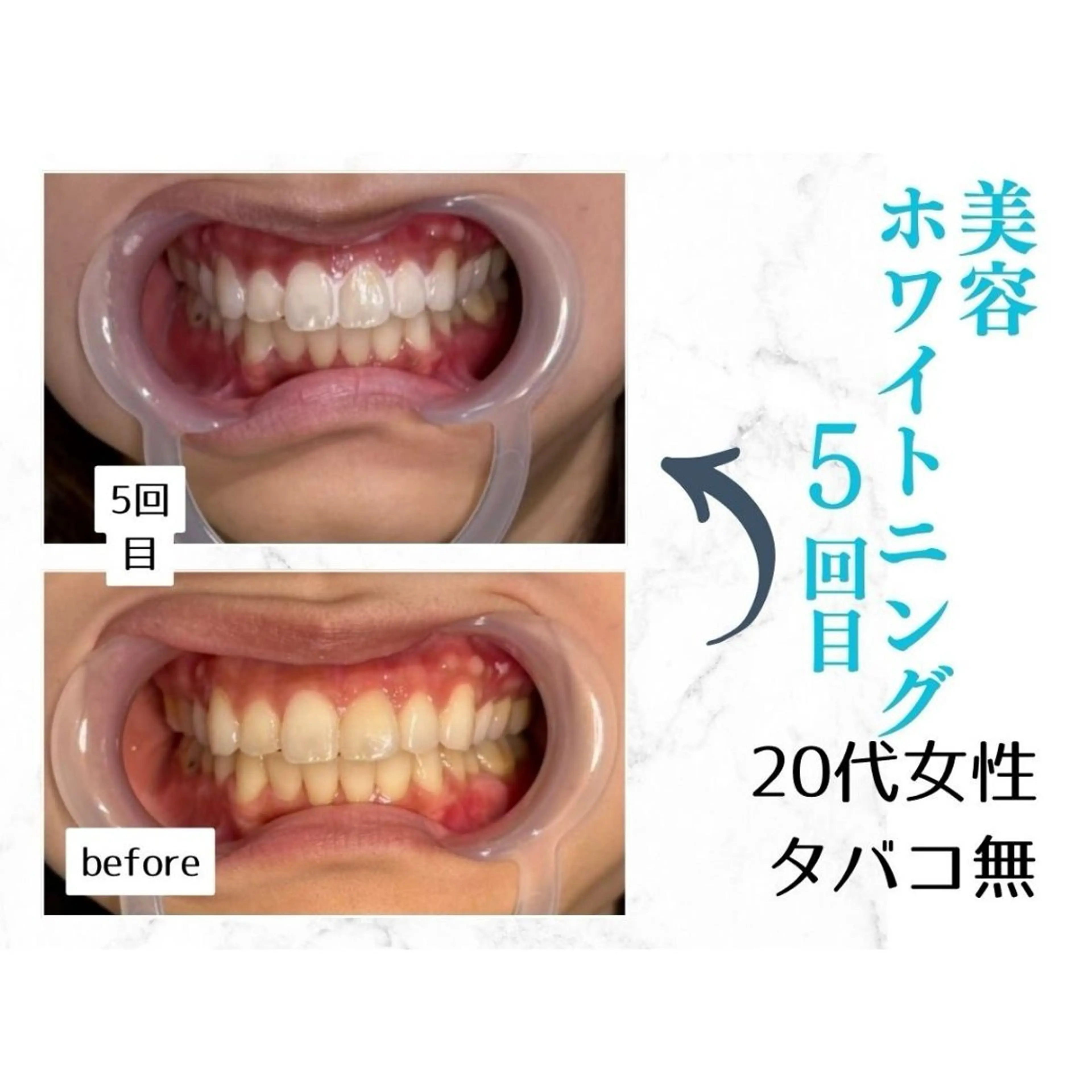 ホワイトニングサロン le  canonのその他イメージ